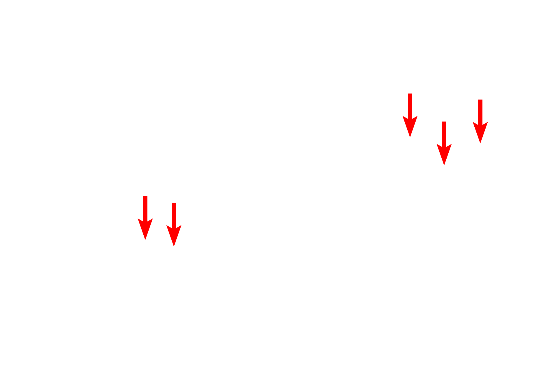  - Centroacinar cells <p>Secretory granules and centroacinar cells, forming the beginning of the pancreatic duct system, are well demonstrated.  Secretory granules that contain enzymes, such as these shown here, are referred to as zymogen granules.  Toluidine blue stain, 1000x, 1000x</p>
