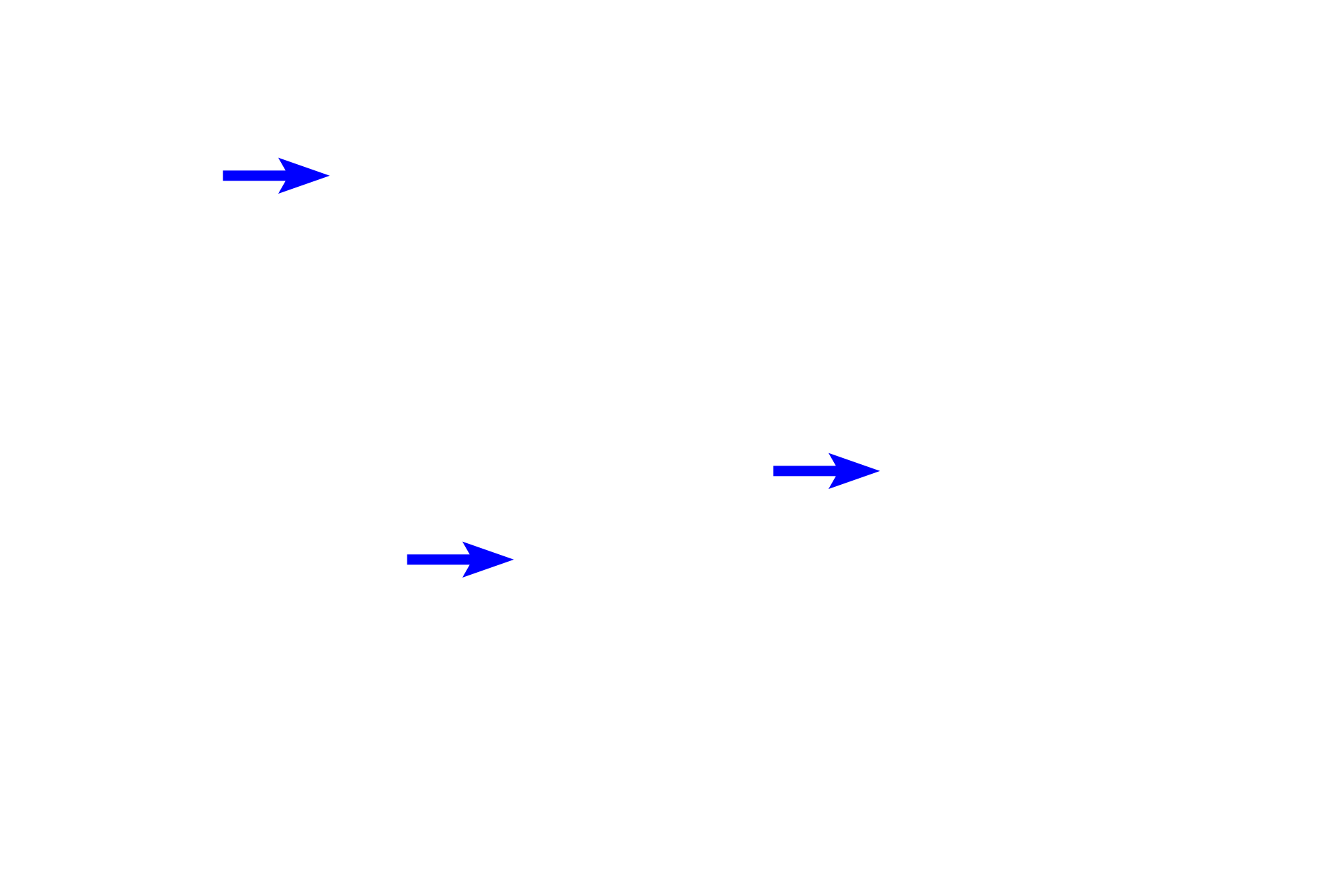 - Rough endoplasmic reticulum <p>An acinus cut in cross section resembles a grapefruit cut in half.  Each grapefruit section represents an acinar cell; the central core of the grapefruit corresponds to the small lumen of the acinus into which the secretory product is released.  1000x</p>

