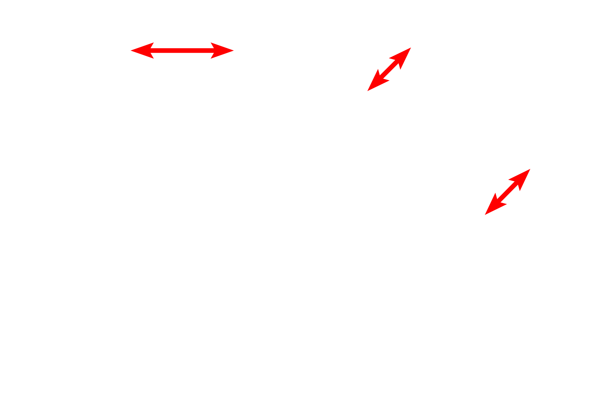  - Rough endoplasmic reticulum <p>This electron micrograph demonstrates the organelles of each secretory cell that forms a part of the spherical acinus.  Secretory product can be seen in the central lumen.  5000x</p>
