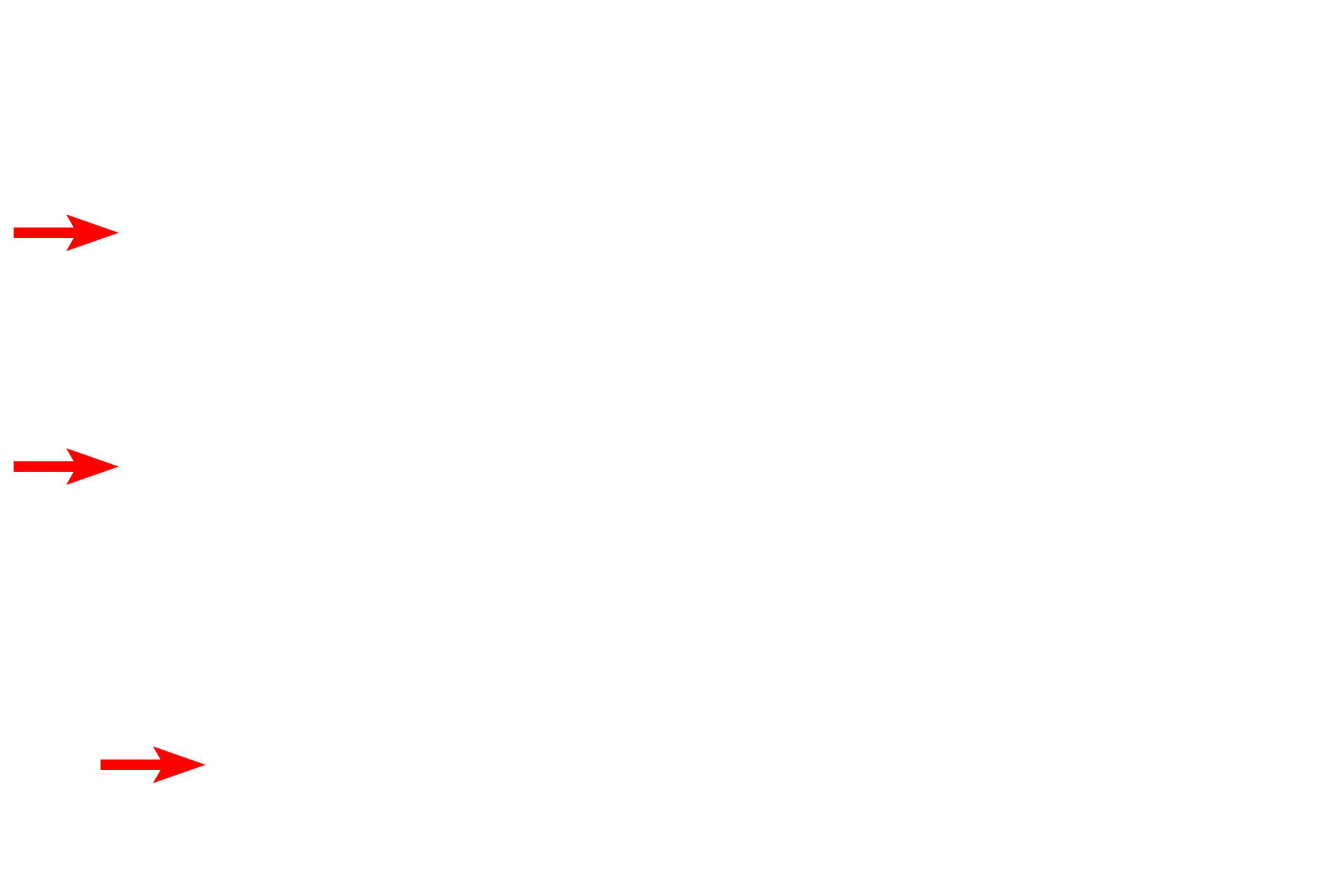  - Rough endoplasmic reticulum <p>This pancreatic acinus shows both the organelles of the acinar cells as well as the exit of an intercalated duct, filled with secretory product.  5000x</p>
