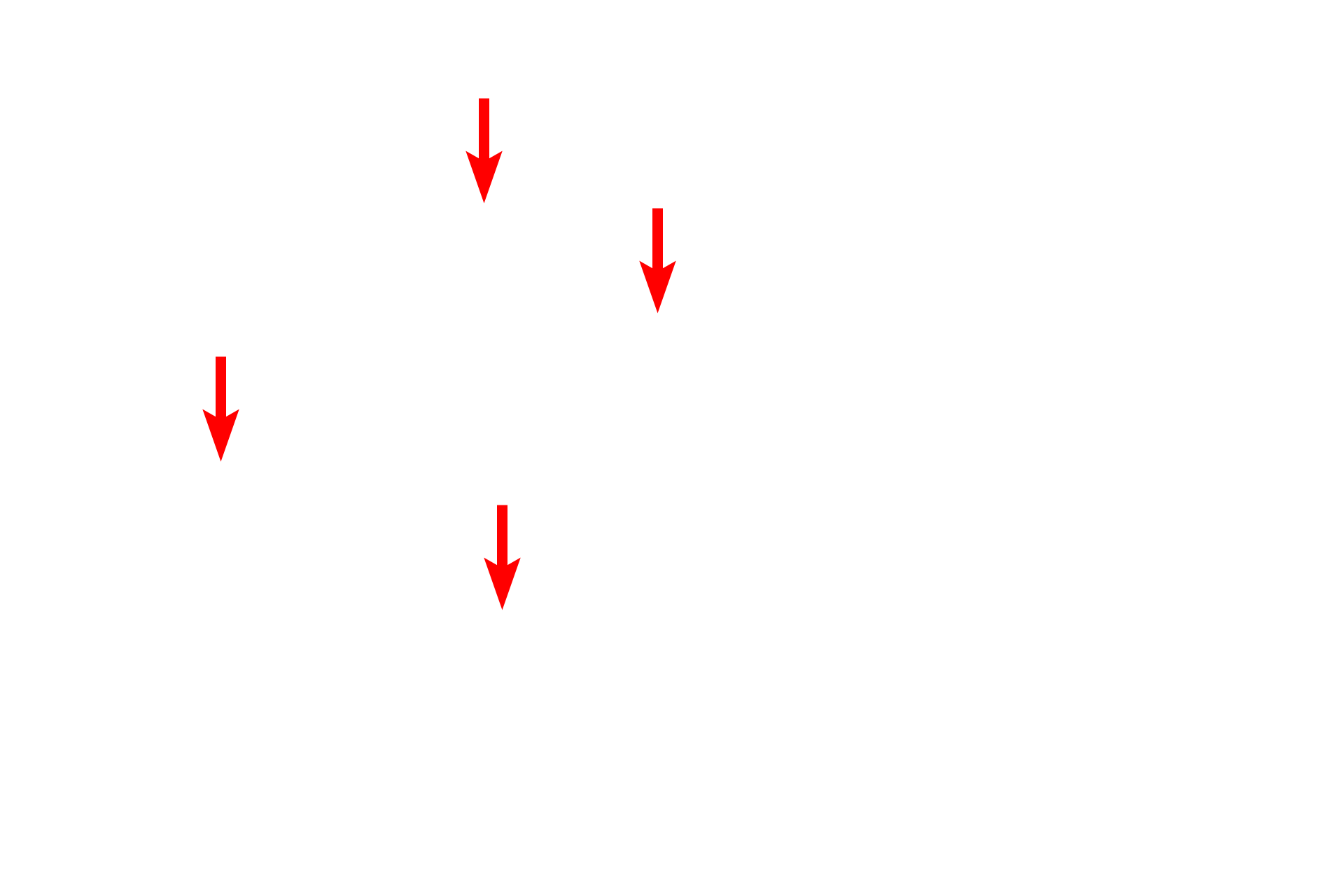  - Secretory granules <p>This pancreatic acinus shows both the organelles of the acinar cells as well as the exit of an intercalated duct, filled with secretory product.  5000x</p>
