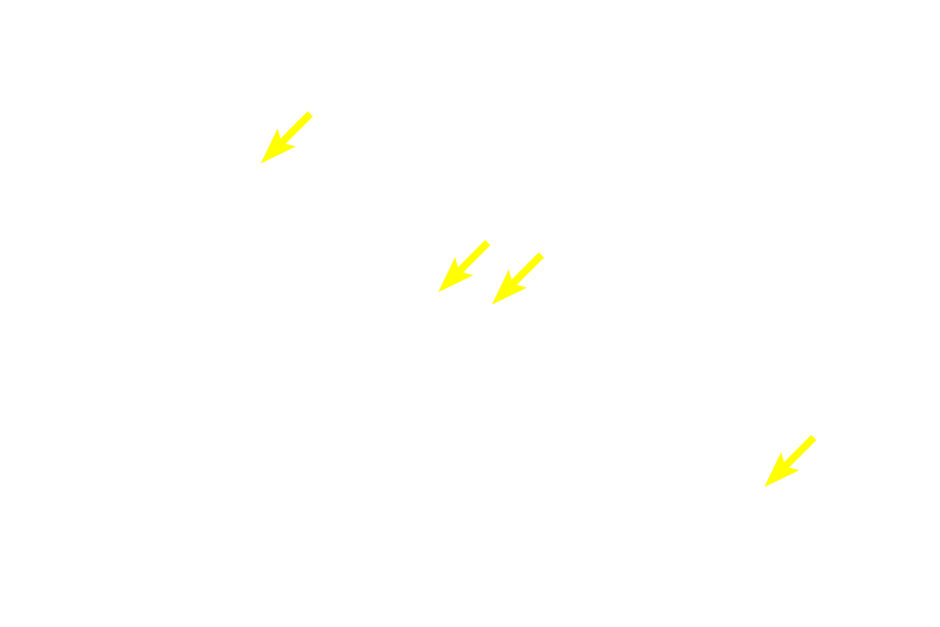 Acini > <p>The exocrine pancreas, a compound acinar gland, comprises most of the pancreas.  The pancreas has fewer intralobular and interlobular ducts than would be expected for a gland of its size and composition.</p>
