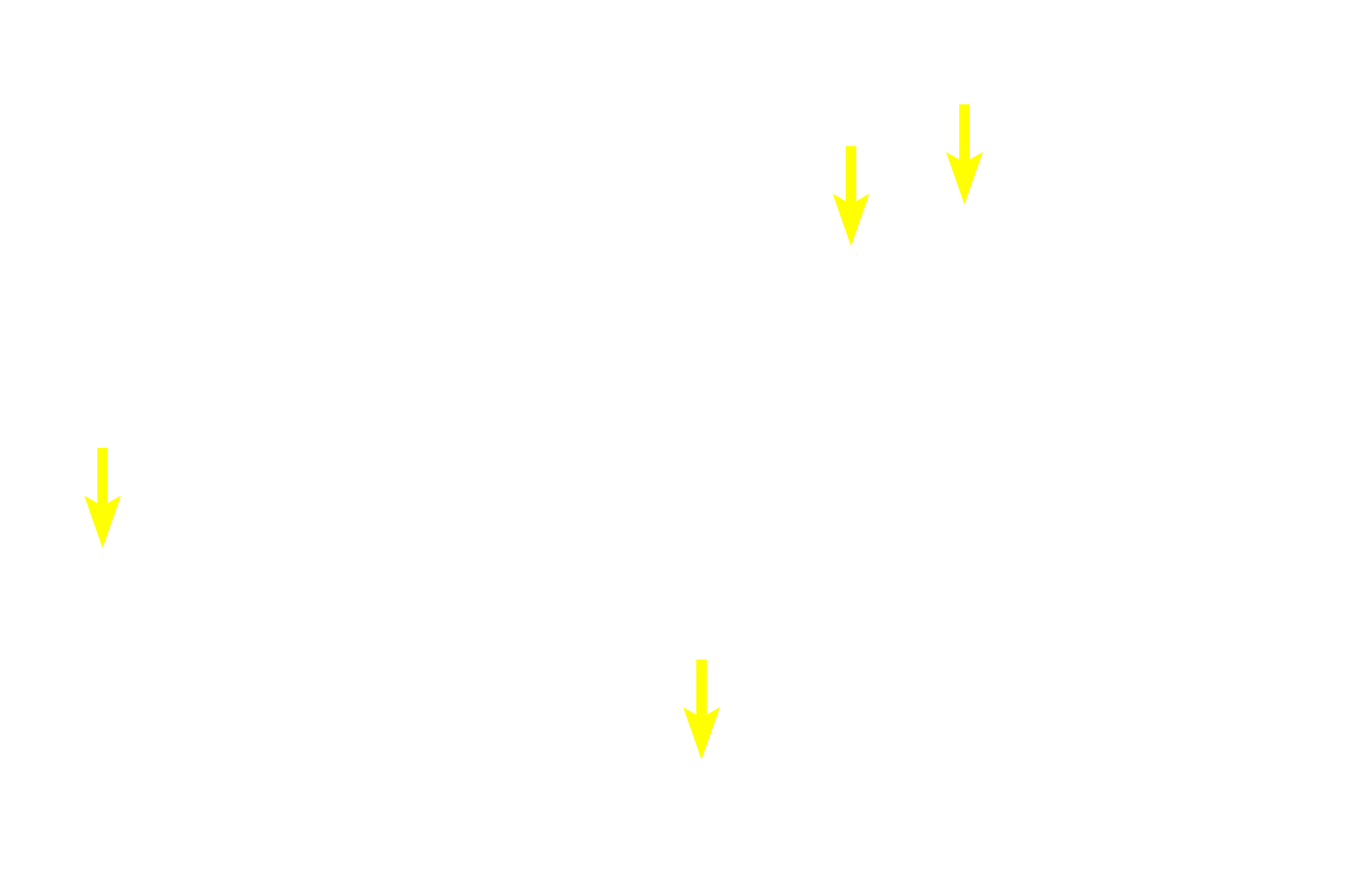 Intralobular duct <p>The exocrine pancreas, a compound acinar gland, comprises most of the pancreas.  The pancreas has fewer intralobular and interlobular ducts than would be expected for a gland of its size and composition.</p>
