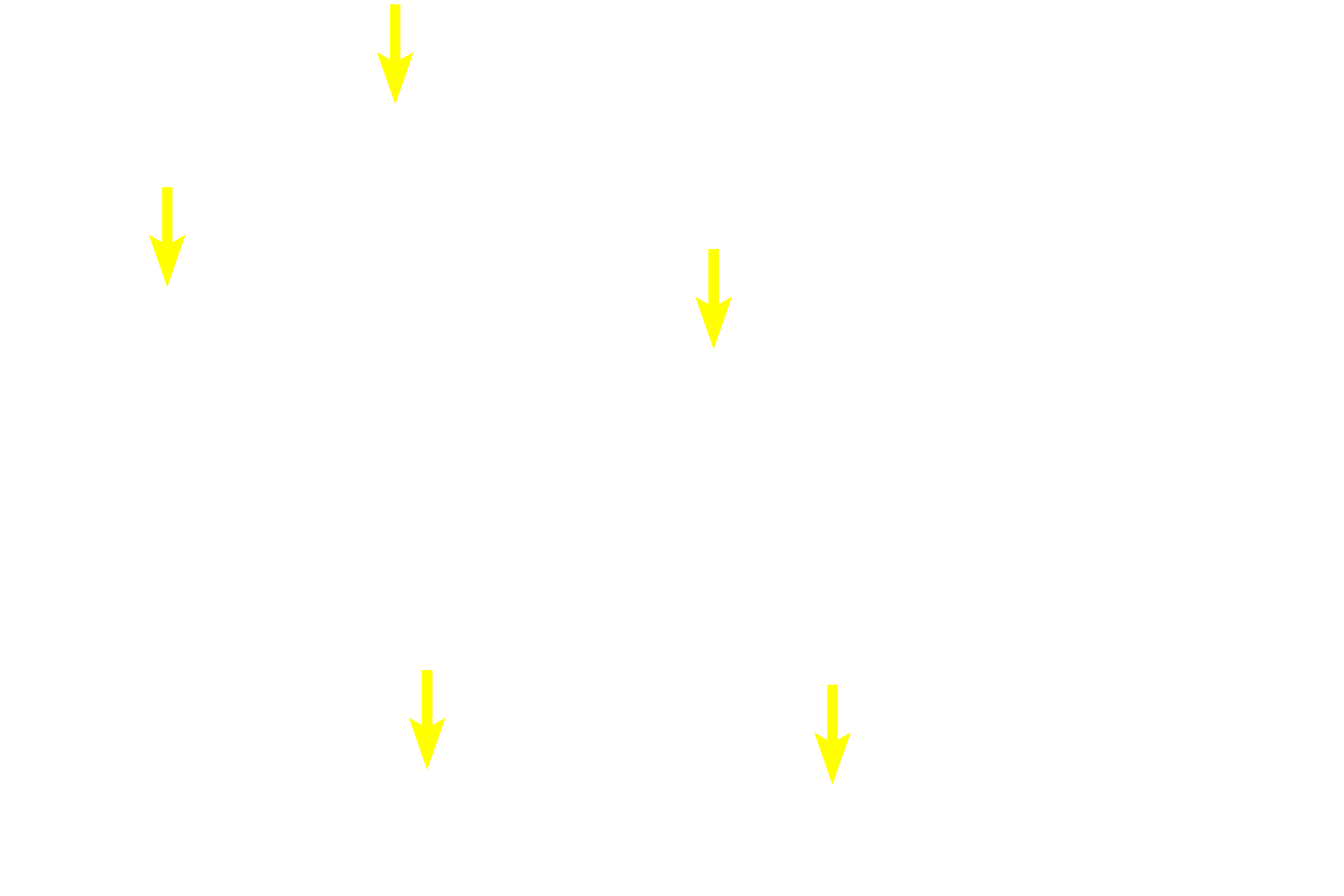 Interlobular CT <p>The exocrine pancreas, a compound acinar gland, comprises most of the pancreas.  The pancreas has fewer intralobular and interlobular ducts than would be expected for a gland of its size and composition.</p>
