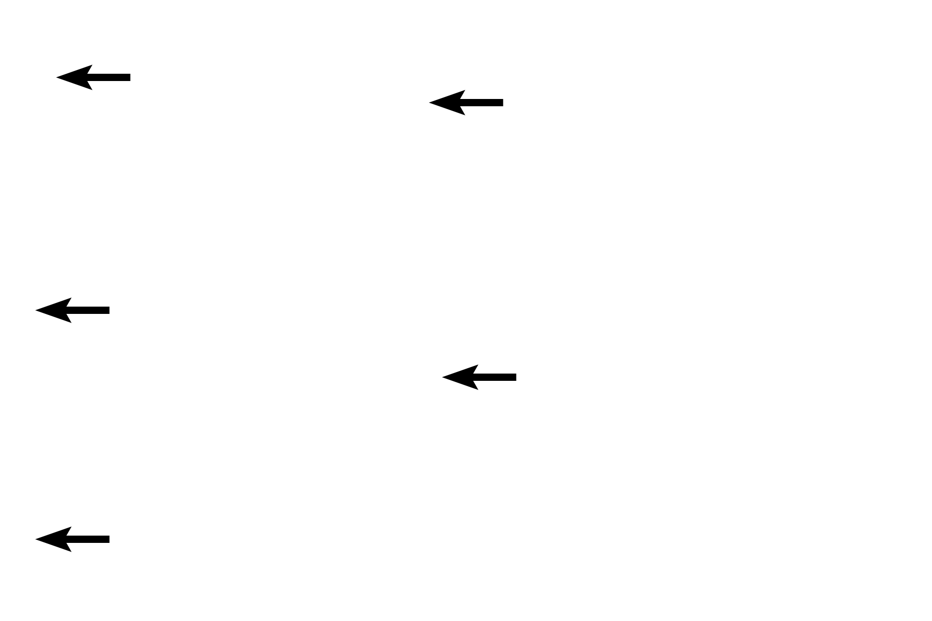 Mucosal epithelium <p>The inner surface of the lip is lined by the mucosal epithelium, a thick, moist stratified squamous epithelium; a stratum granulosum is absent.  Minor salivary glands (labial glands) are located in the submucosa beneath the lamina propria.  The minor salivary glands produce both serous and mucous secretions.  Mucosal epithelium also lines the cheeks, floor of the mouth and the ventral surface of the tongue.  10x, 100x</p>
