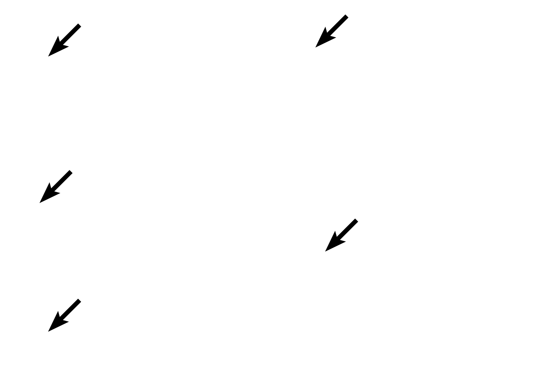  - Lamina propria <p>The inner surface of the lip is lined by the mucosal epithelium, a thick, moist stratified squamous epithelium; a stratum granulosum is absent.  Minor salivary glands (labial glands) are located in the submucosa beneath the lamina propria.  The minor salivary glands produce both serous and mucous secretions.  Mucosal epithelium also lines the cheeks, floor of the mouth and the ventral surface of the tongue.  10x, 100x</p>

