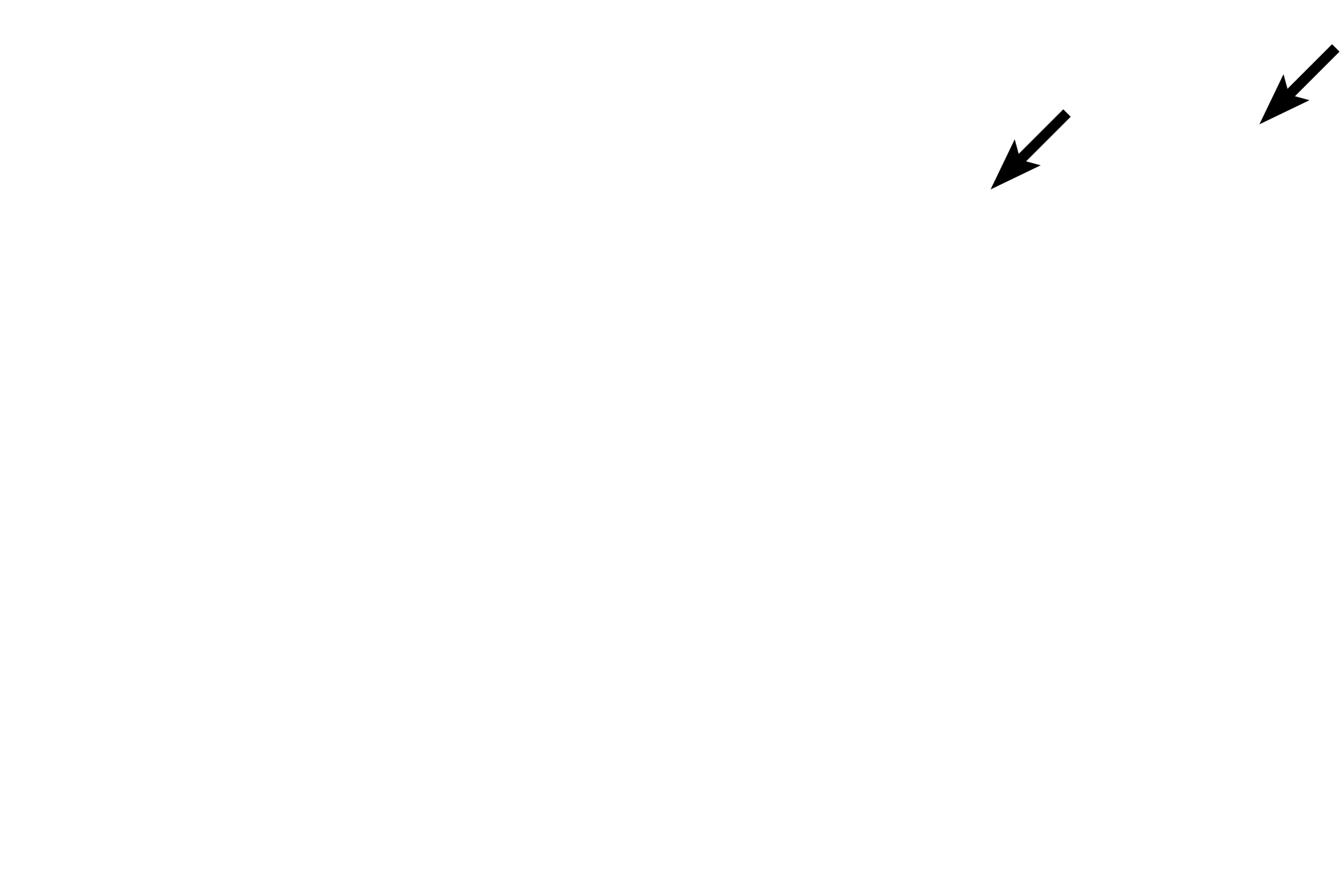 Specialized mucosa > <p>Specialized mucosa lines the dorsal surface of the tongue.  The epithelium of this mucosa is keratinized, but is modified into three types of papillae, only one type (arrows) is shown here.  Some papillae serve mechanical functions, while others possess taste buds.  Specialized mucosa is discussed more completely in the section on the tongue.</p>
