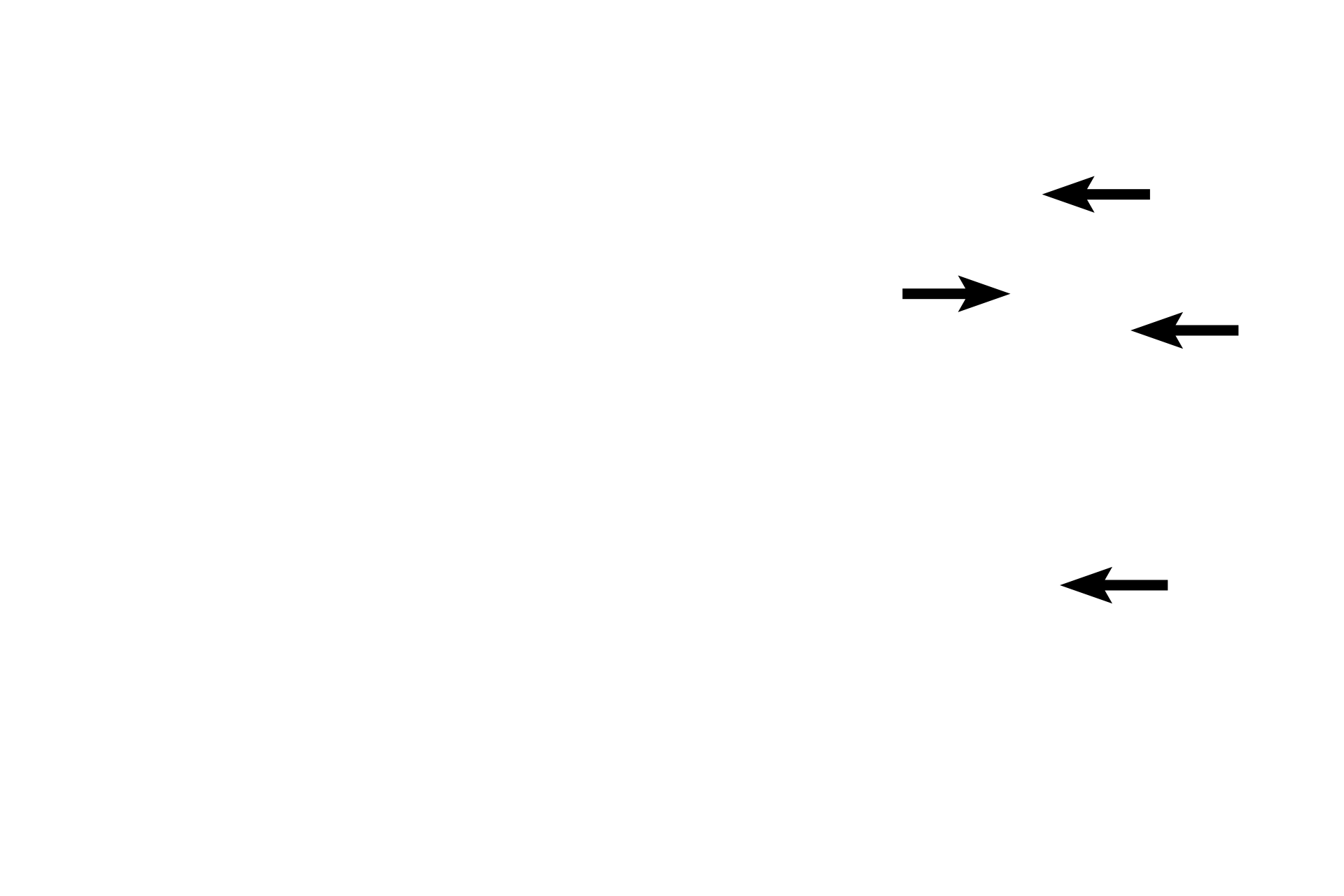  - Ducts of glands <p>Lining mucosa lines all of the oral cavity except the gingiva, hard palate, and the dorsum of the tongue.  It is composed of stratified squamous moist epithelium and its underlying lamina propria; a muscularis mucosae is lacking.  A submucosa lies beneath the mucosa and usually contains the minor salivary glands (mixed glands).  100x</p>
