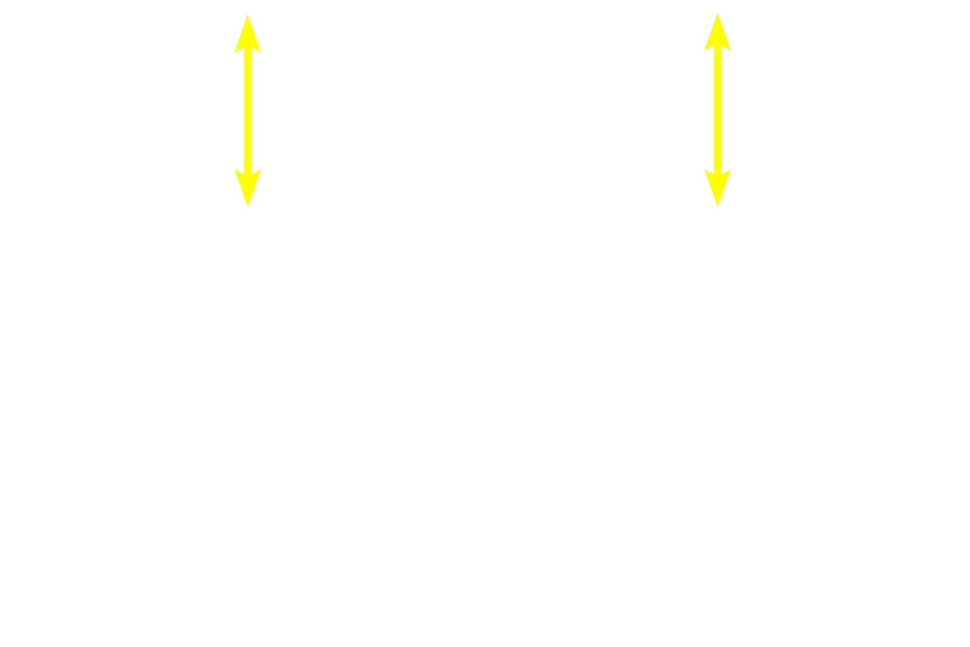 Epithelium <p>The epithelium of lining mucosa is stratified squamous moist; epithelial pegs (ridges) are short.  The lamina propria in the oral cavity, like the dermis of the skin, is subdivided into a papillary portion immediately beneath the epithelium and a reticular portion of denser connective tissue.  The submucosa, underlying the mucosa, contains minor salivary glands.  200x</p>
