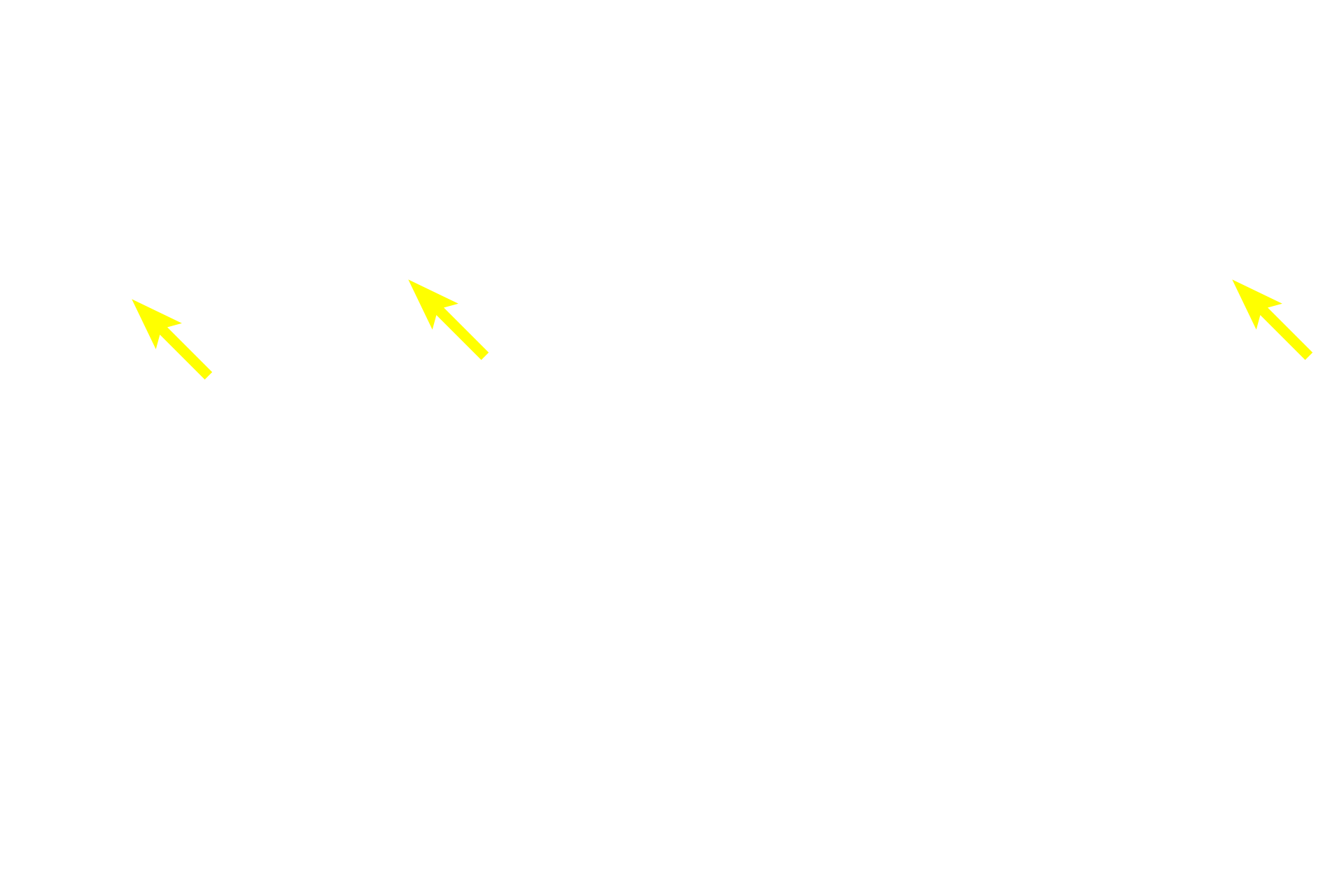  - Epidermal pegs <p>The epithelium of lining mucosa is stratified squamous moist; epithelial pegs (ridges) are short.  The lamina propria in the oral cavity, like the dermis of the skin, is subdivided into a papillary portion immediately beneath the epithelium and a reticular portion of denser connective tissue.  The submucosa, underlying the mucosa, contains minor salivary glands.  200x</p>
