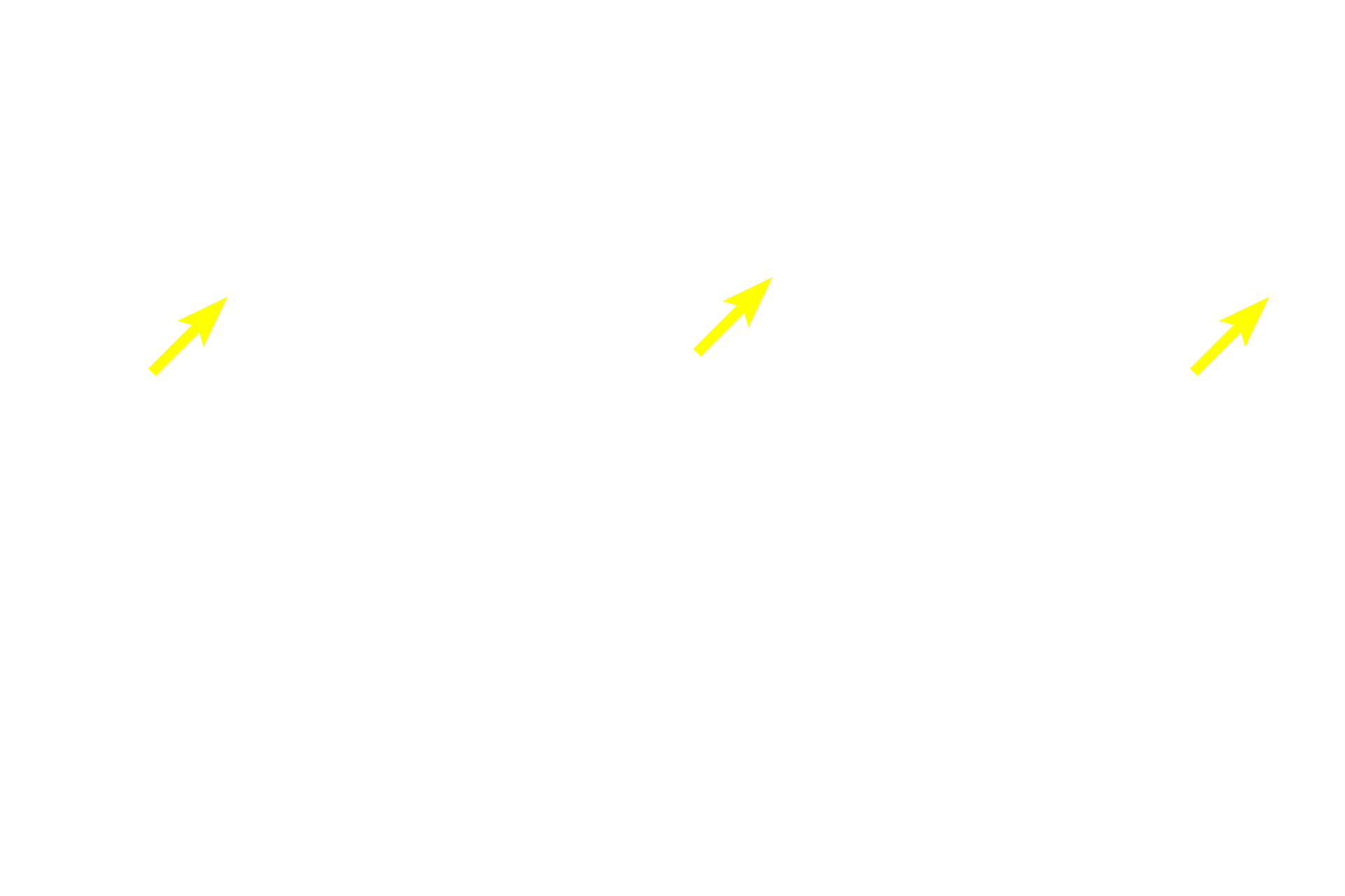 - Papillary layer of lamina propria <p>The epithelium of lining mucosa is stratified squamous moist; epithelial pegs (ridges) are short.  The lamina propria in the oral cavity, like the dermis of the skin, is subdivided into a papillary portion immediately beneath the epithelium and a reticular portion of denser connective tissue.  The submucosa, underlying the mucosa, contains minor salivary glands.  200x</p>
