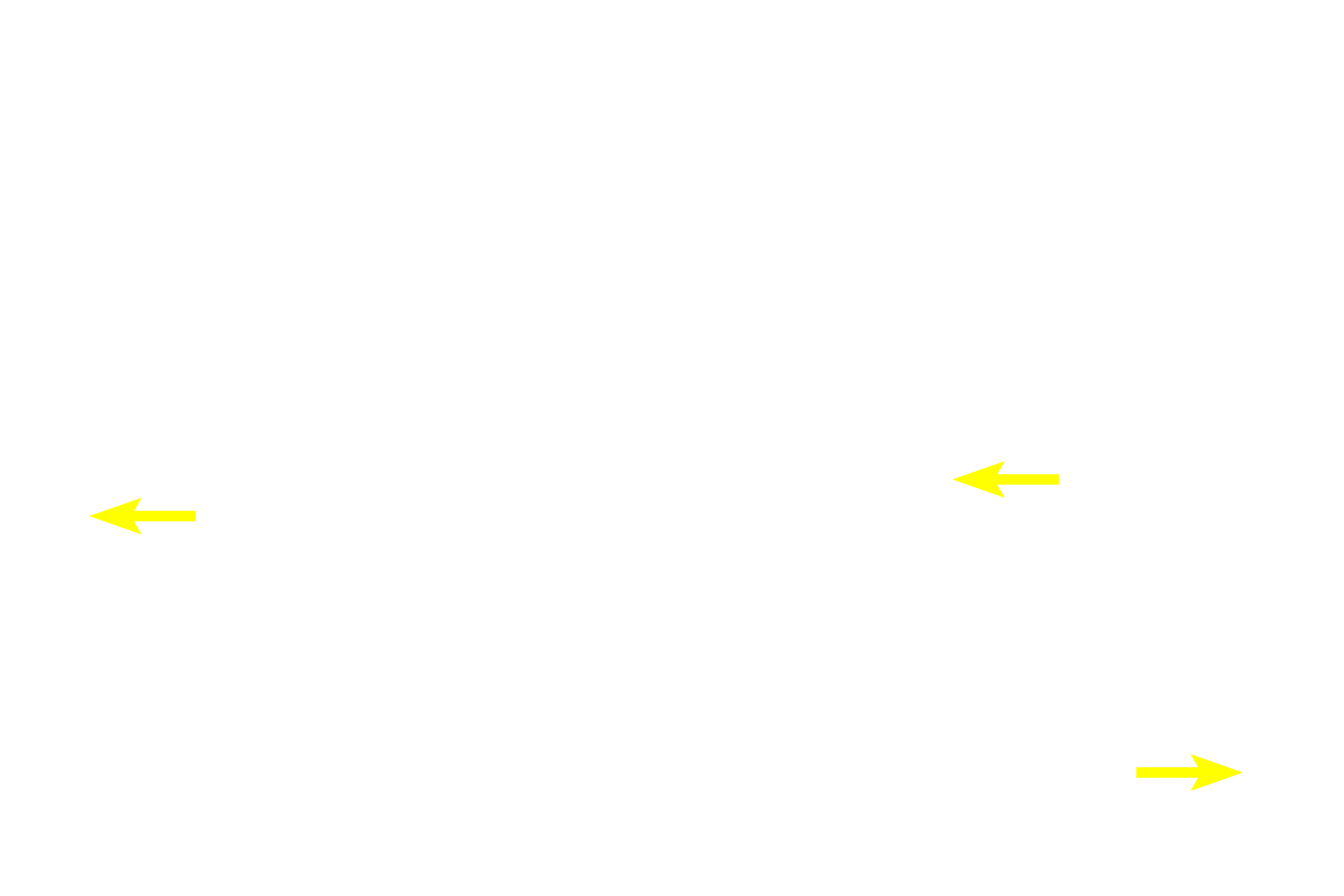  - Gland ducts <p>The epithelium of lining mucosa is stratified squamous moist; epithelial pegs (ridges) are short.  The lamina propria in the oral cavity, like the dermis of the skin, is subdivided into a papillary portion immediately beneath the epithelium and a reticular portion of denser connective tissue.  The submucosa, underlying the mucosa, contains minor salivary glands.  200x</p>
