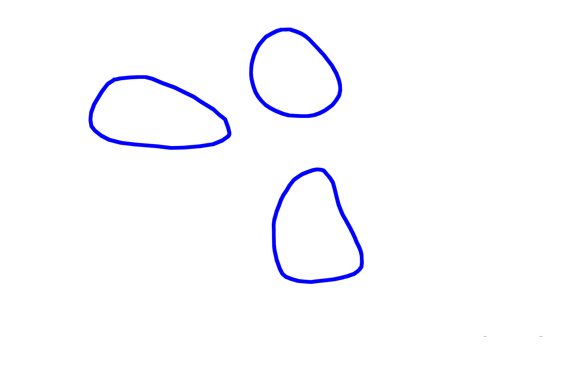 Lobules > <p>A capsule surrounds each gland, extending interlobular, connective tissue septa into the gland, forming lobules.  A lobule is a cluster of secretory units and the ducts that drain them.   An intralobular duct leaves one lobule and anastomoses with ducts from adjacent lobules to form interlobular ducts.  Interlobular ducts, in turn, combine to form excretory, or main, duct(s) (box at far right) of the gland.</p>
