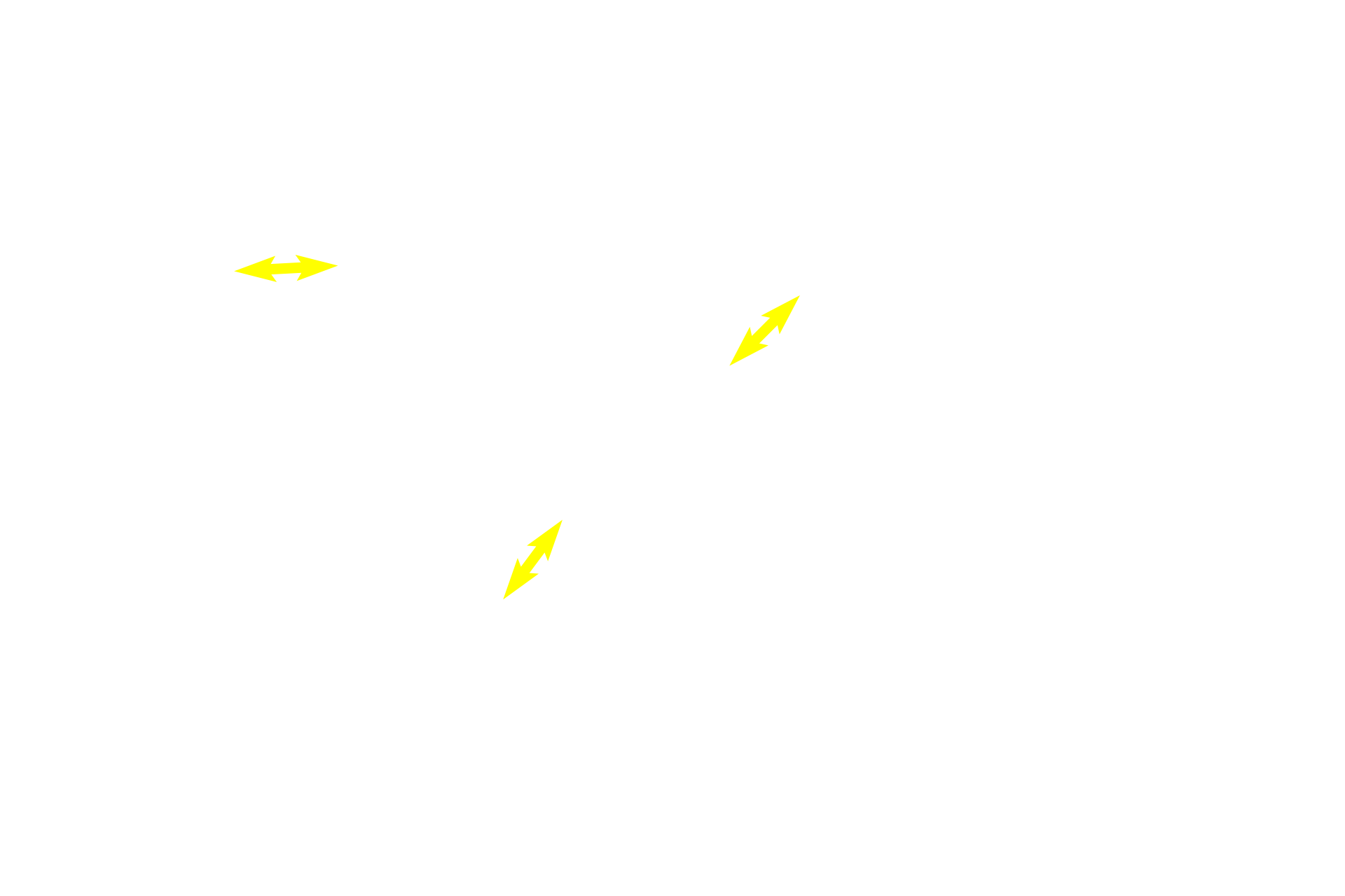  - Stratified columnar epithelium <p>Intralobular ducts exit the lobules to form interlobular ducts located in the dense irregular connective tissue surrounding the lobules.  As these ducts increase in diameter, their epithelium frequently becomes stratified columnar and eventually transitions to the stratified squamous epithelium of the vestibule into which they will empty.  100x</p>
