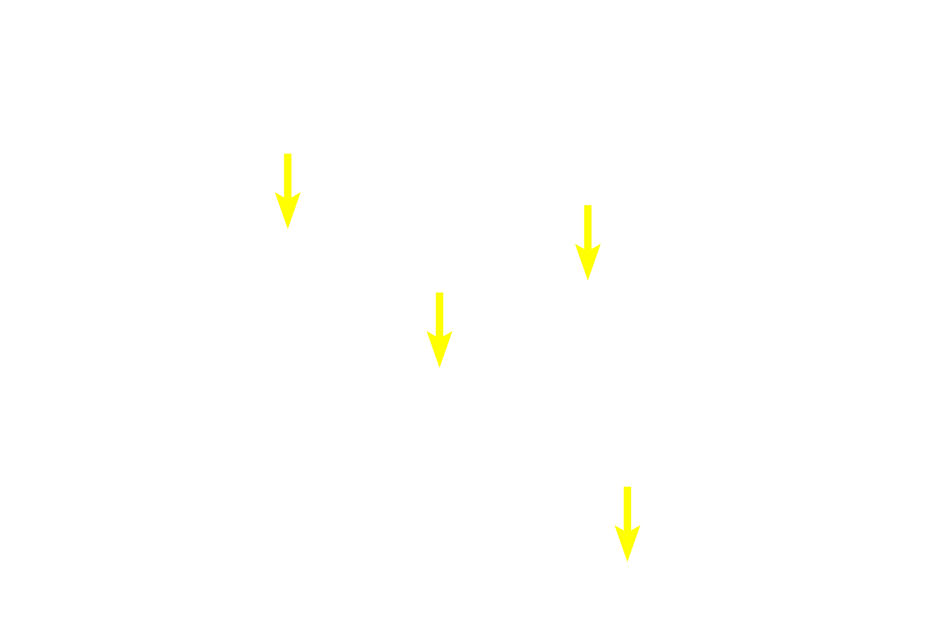 Serous acini <p>Mucus-secreting cells are arranged in tubules that stain lighter and appear more frothy than do the serous-producing cells.  Serous cells may be arranged either in acini or in serous demilunes, half-moon shaped caps of serous-secreting cells located over the ends of mucous tubules.  Striated ducts are well developed in this salivary gland.  100x</p>
