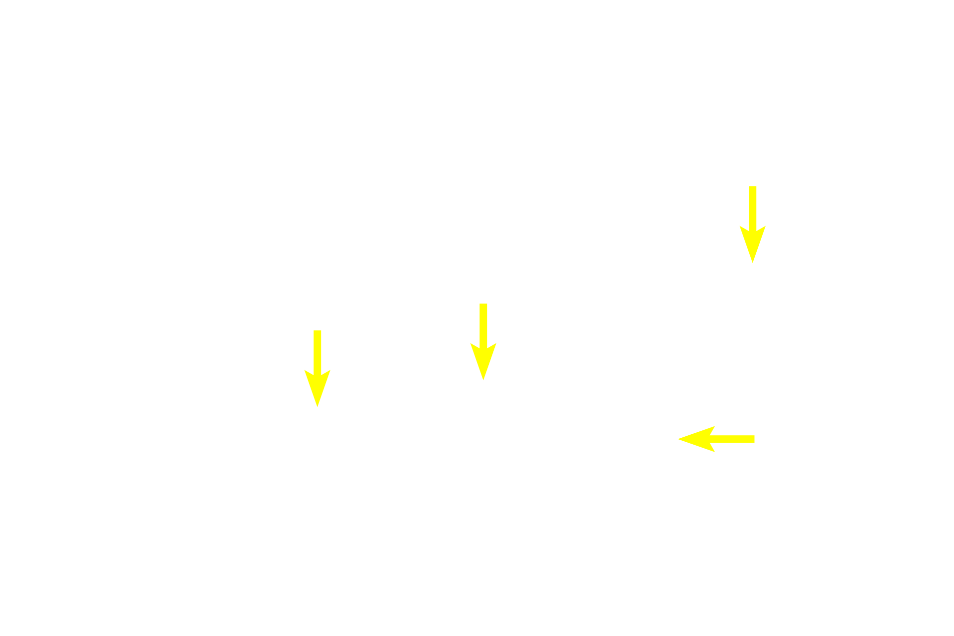 Mucous tubules <p>The submandibular gland possesses both serous acini and mucous tubules.  The tubules are pale staining and the cells secrete mucus.  Acini stain more intensely because of the numerous secretory granules they contain.  An intercalated duct with a simple cuboidal epithelium and a striated duct with a simple columnar epithelium are present.  200x</p>
