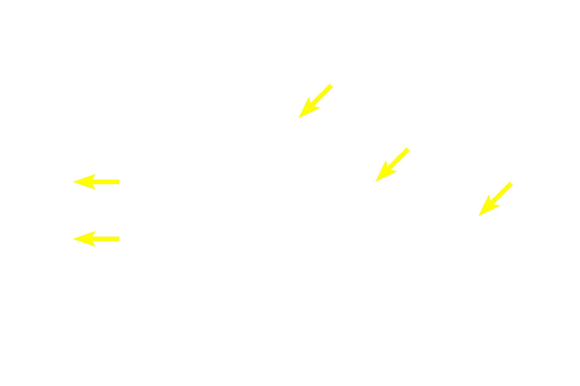 Mucus tubules <p>The difference in staining qualities between serous acini and mucous tubules is obvious.  Mucous tubules are elongated and stain palely due to the frothy, mucus content of the tubule cells.  In contrast, the cytoplasm of the serous acinar cells stains darkly, reflecting their numerous secretory granules.  No ducts are visible here.  400x</p>
