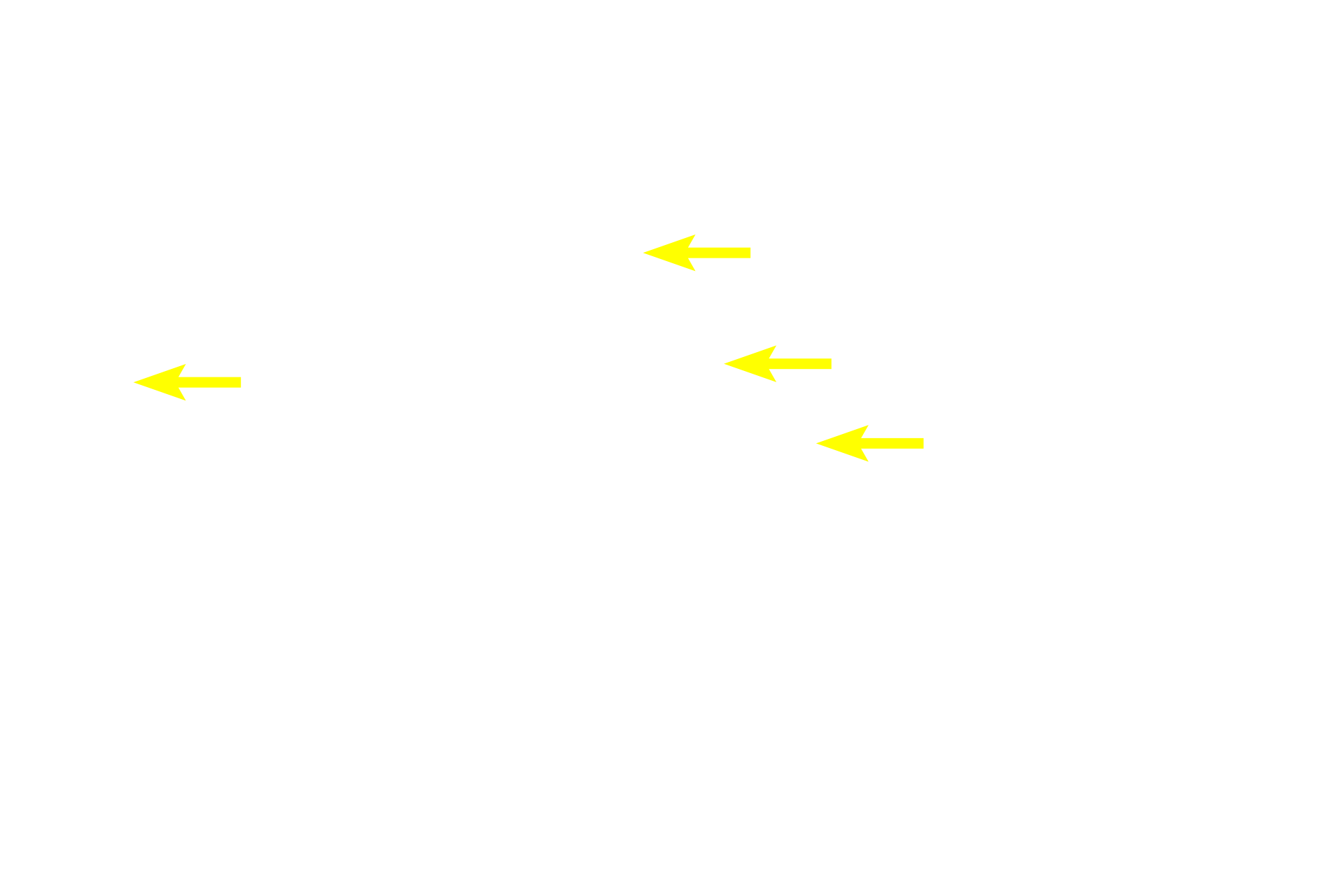  - Mucous tubule lumens > <p>The lumens of mucus tubules are larger than those of acini, allowing passage of the thicker secretory product the tubules produce.</p>
