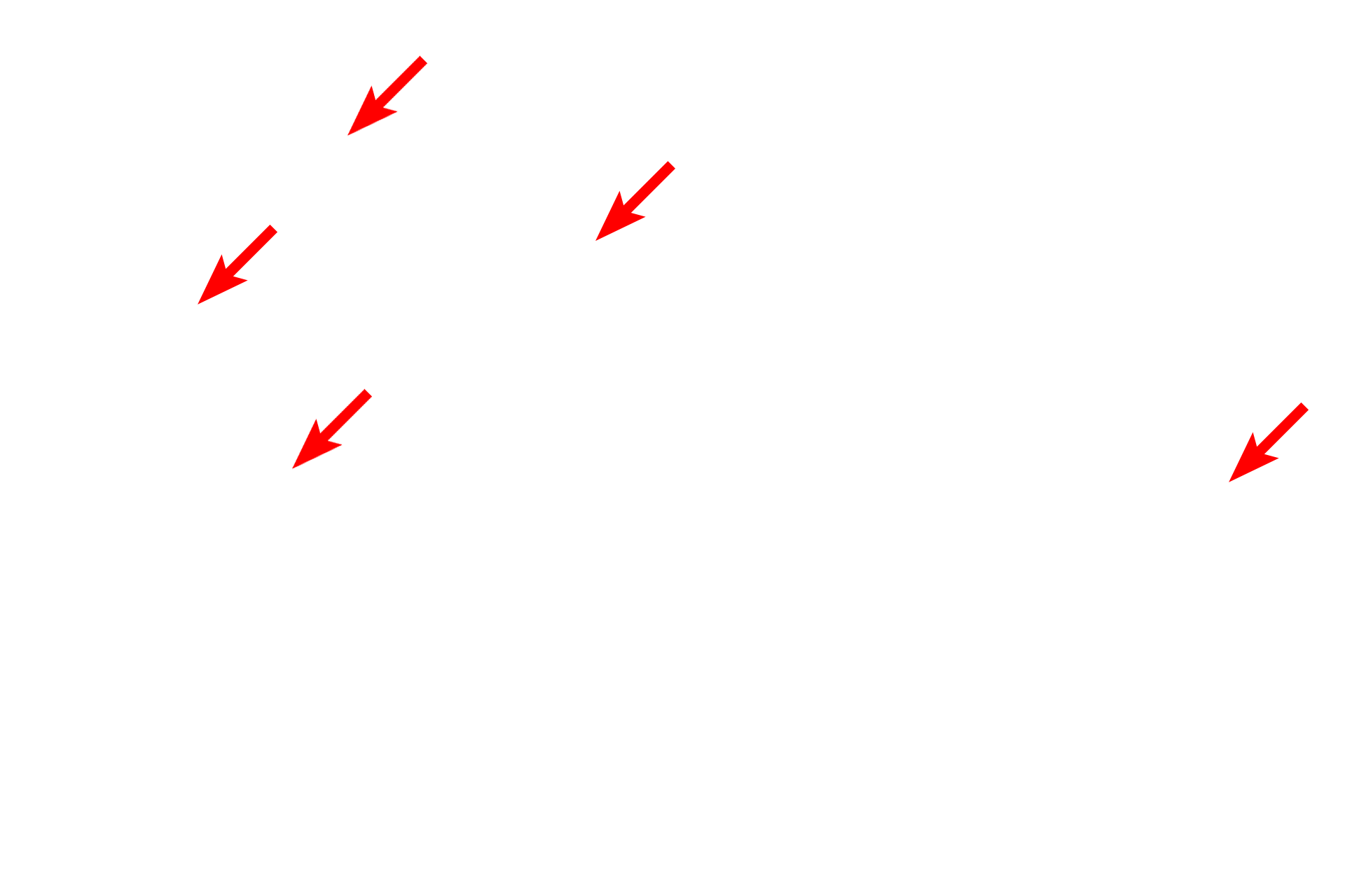  - Secretory granules <p>Serous-secreting acini stain more intensely than do the tubules.  Acini resemble grapefruits cut in cross section, with each grapefruit wedge representing an individual cell.  Secretory granules fill the apex of each cell, lying adjacent to the acinar lumen into which they will be released.  The lumen of each acinus is smaller than that of a tubule.</p>
