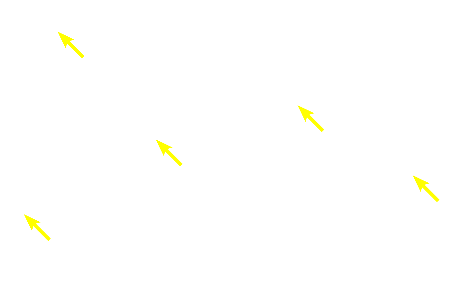 Mucous tubules <p>The sublingual glands, paired, compound tubuloacinar glands, lie in the floor of the mouth and open by multiple ducts into that area.  Mucous tubules predominate and serous-secreting cells are most frequently arranged as serous demilunes.  Intralobular ducts are less numerous here because of the abundance of tubules, which serve as their own ducts.  40x</p>

