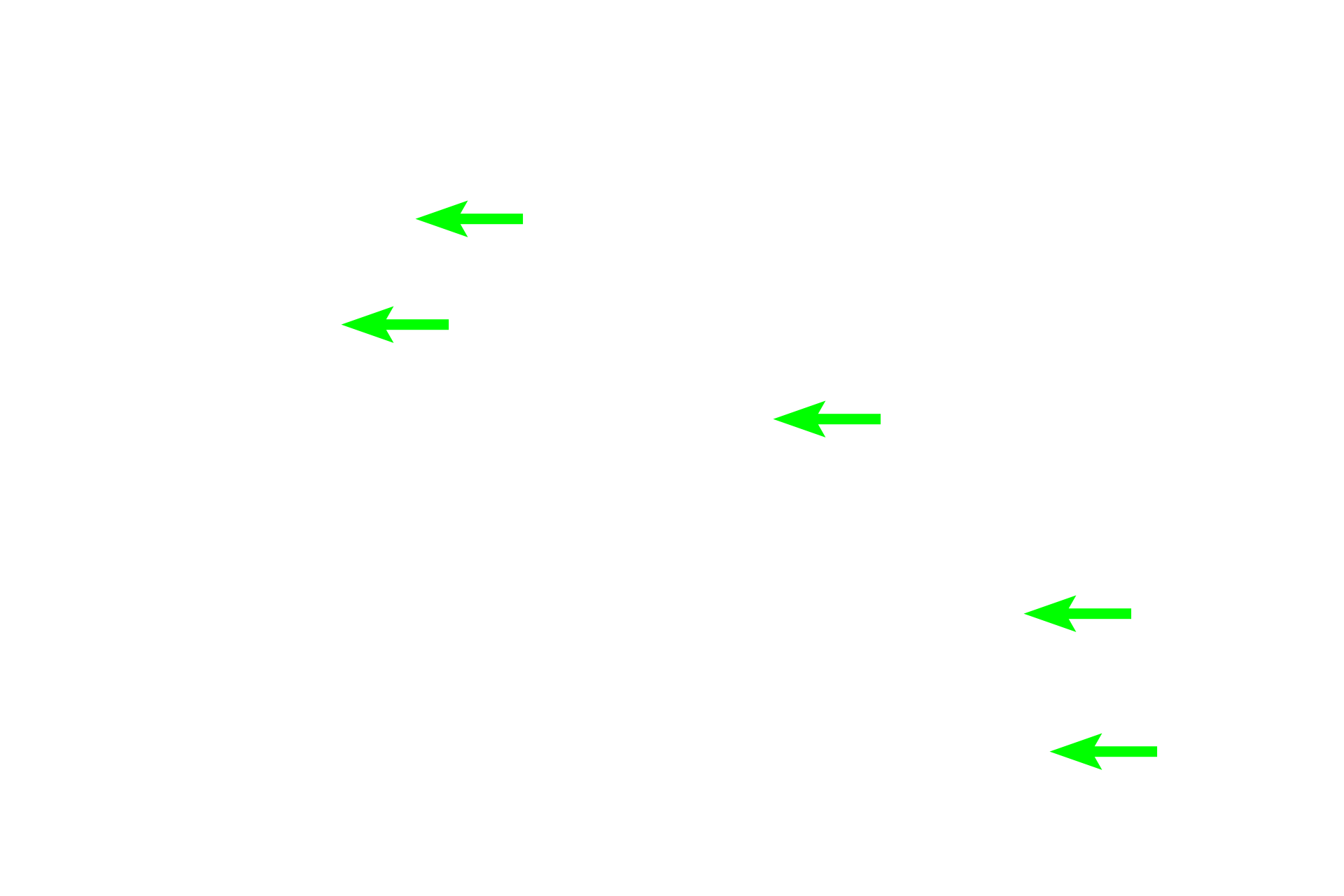 Mucous tubules <p>At higher magnification, the abundance of the palely stained, mucous tubules is obvious.  A large number of striated, intralobular ducts is present, not usual for the sublingual gland.  200x</p>
