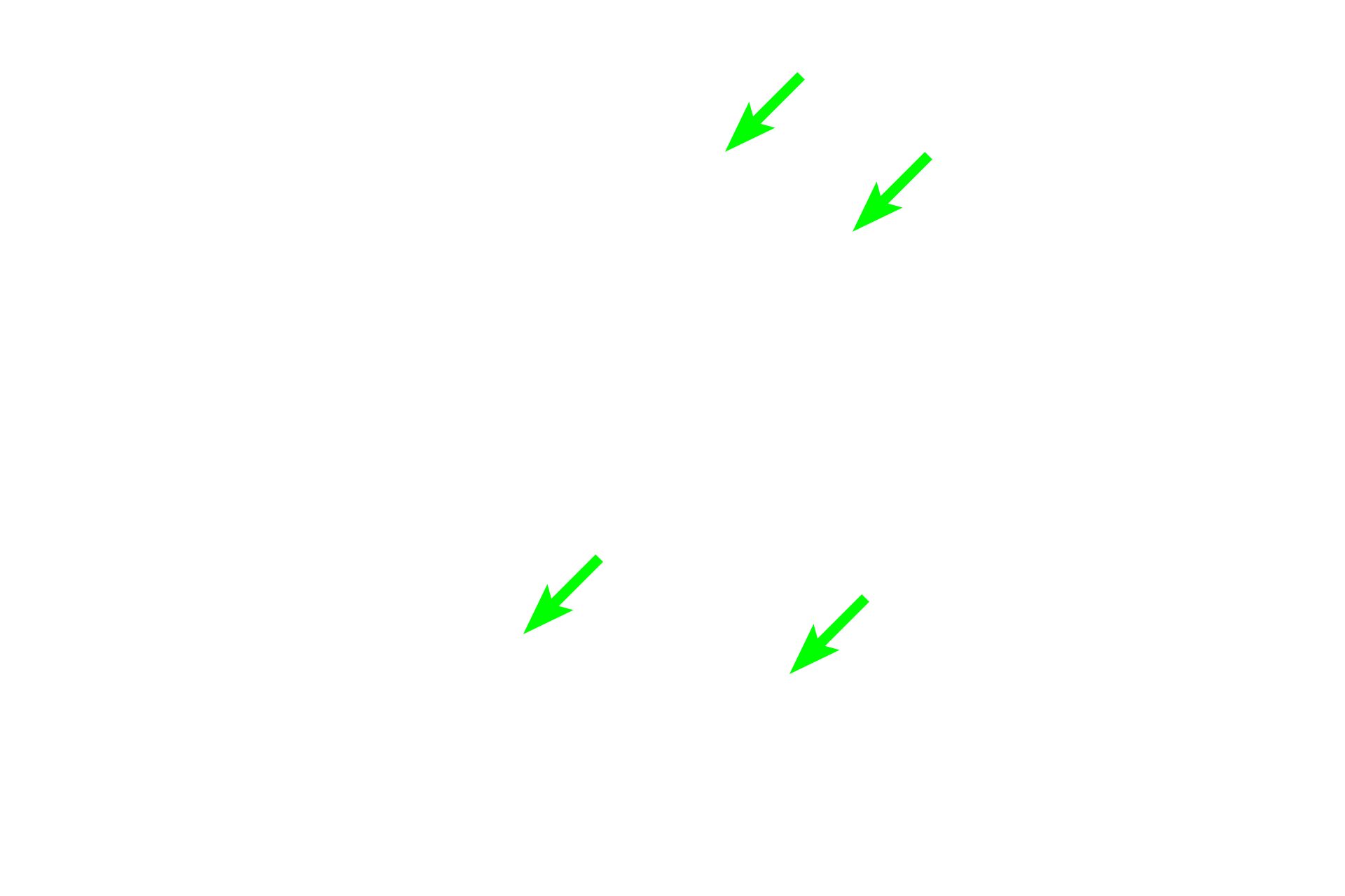 Striated ducts <p>At higher magnification, the abundance of the palely stained, mucous tubules is obvious.  A large number of striated, intralobular ducts is present, not usual for the sublingual gland.  200x</p>
