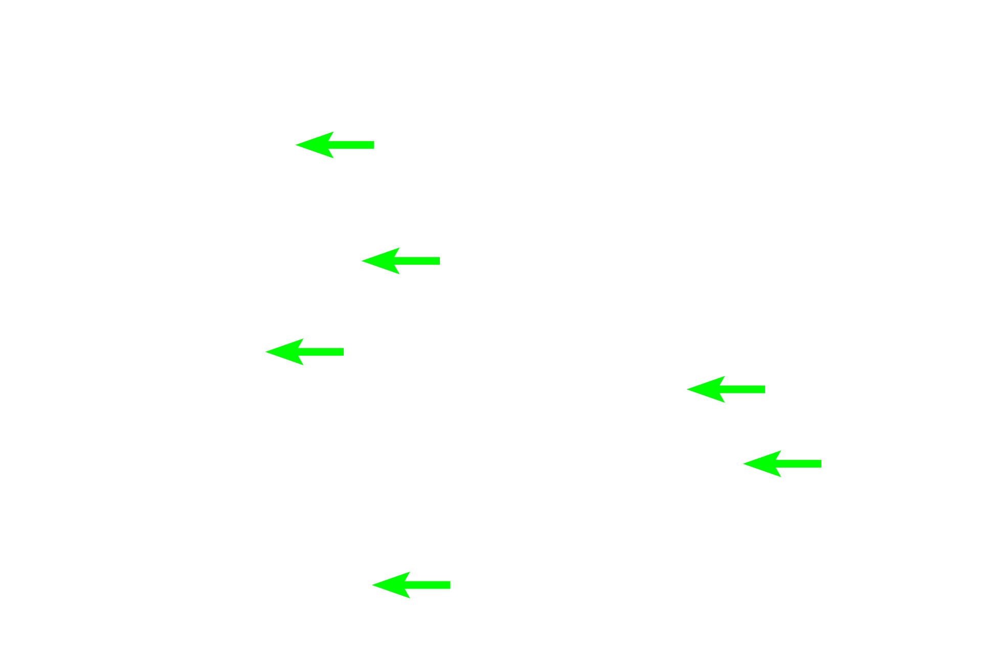  - Tubule lumens <p>At higher magnification, the abundance of the palely stained, mucous tubules is obvious.  A large number of striated, intralobular ducts is present, not usual for the sublingual gland.  200x</p>
