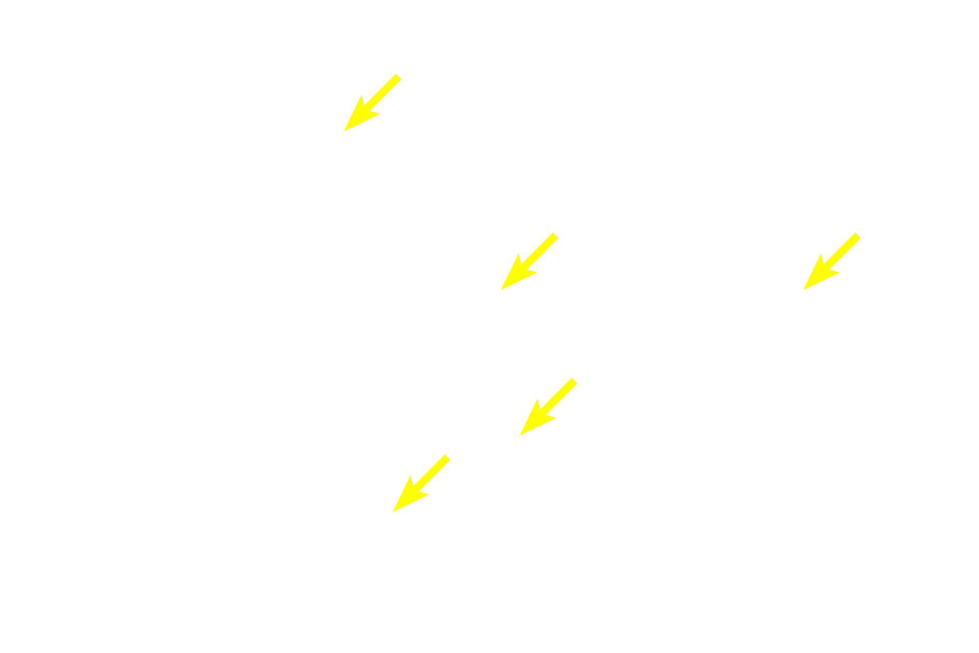 Intralobular ducts <p>The paired parotid glands are compound acinar glands and, thus, contribute only serous products to saliva.  Because of the presence of acini, the parotids have abundant striated ducts and the most intercalated ducts of the salivary glands.  The parotid lies anterior to the ear, and its main duct empties into the vestibule opposite the upper second molar tooth.  10x</p>
