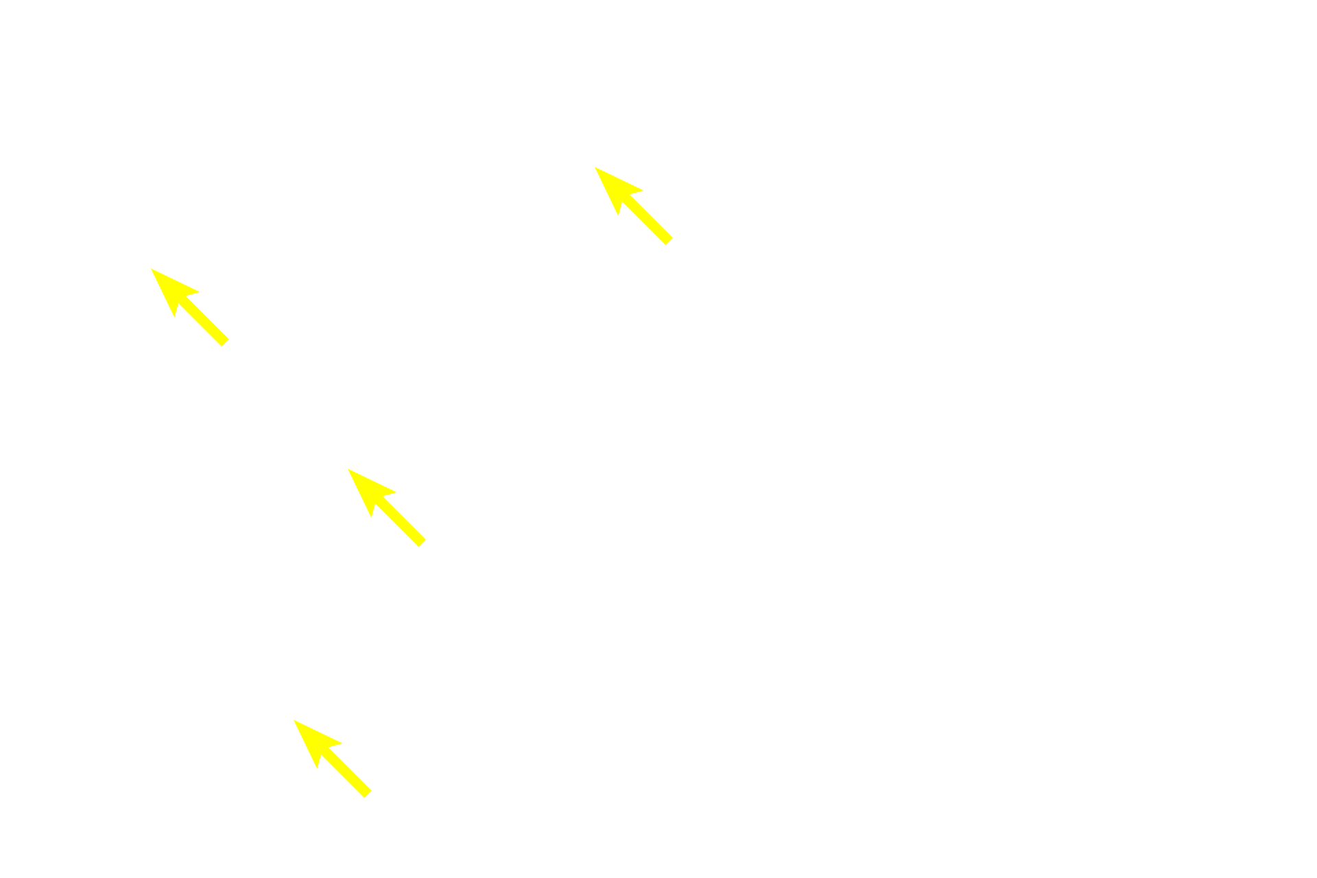 Acini <p>This higher magnification image shows a group of lobules surrounded by interlobular connective tissue.  In the parotid, each of these lobules consists of serous acini and the intralobular duct system.  Secretory cells release their thin, watery secretions into a small lumen in the center of the acinus.  From there, the fluid drains into intercalated ducts (not visible at this magnification), then intralobular ducts that anastomose to form larger interlobular ducts located in the surrounding connective tissue.  100x</p>
