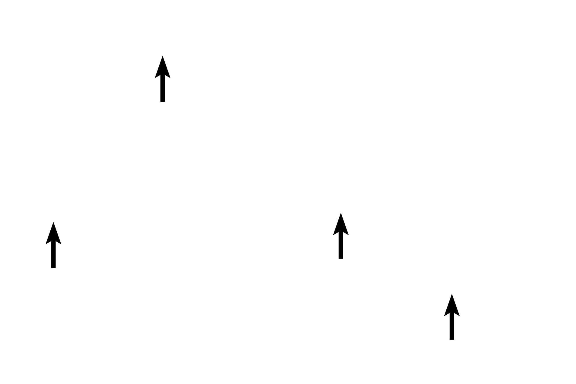 Interlobular connective tissue <p>This higher magnification image shows a group of lobules surrounded by interlobular connective tissue.  In the parotid, each of these lobules consists of serous acini and the intralobular duct system.  Secretory cells release their thin, watery secretions into a small lumen in the center of the acinus.  From there, the fluid drains into intercalated ducts (not visible at this magnification), then intralobular ducts that anastomose to form larger interlobular ducts located in the surrounding connective tissue.  100x</p>
