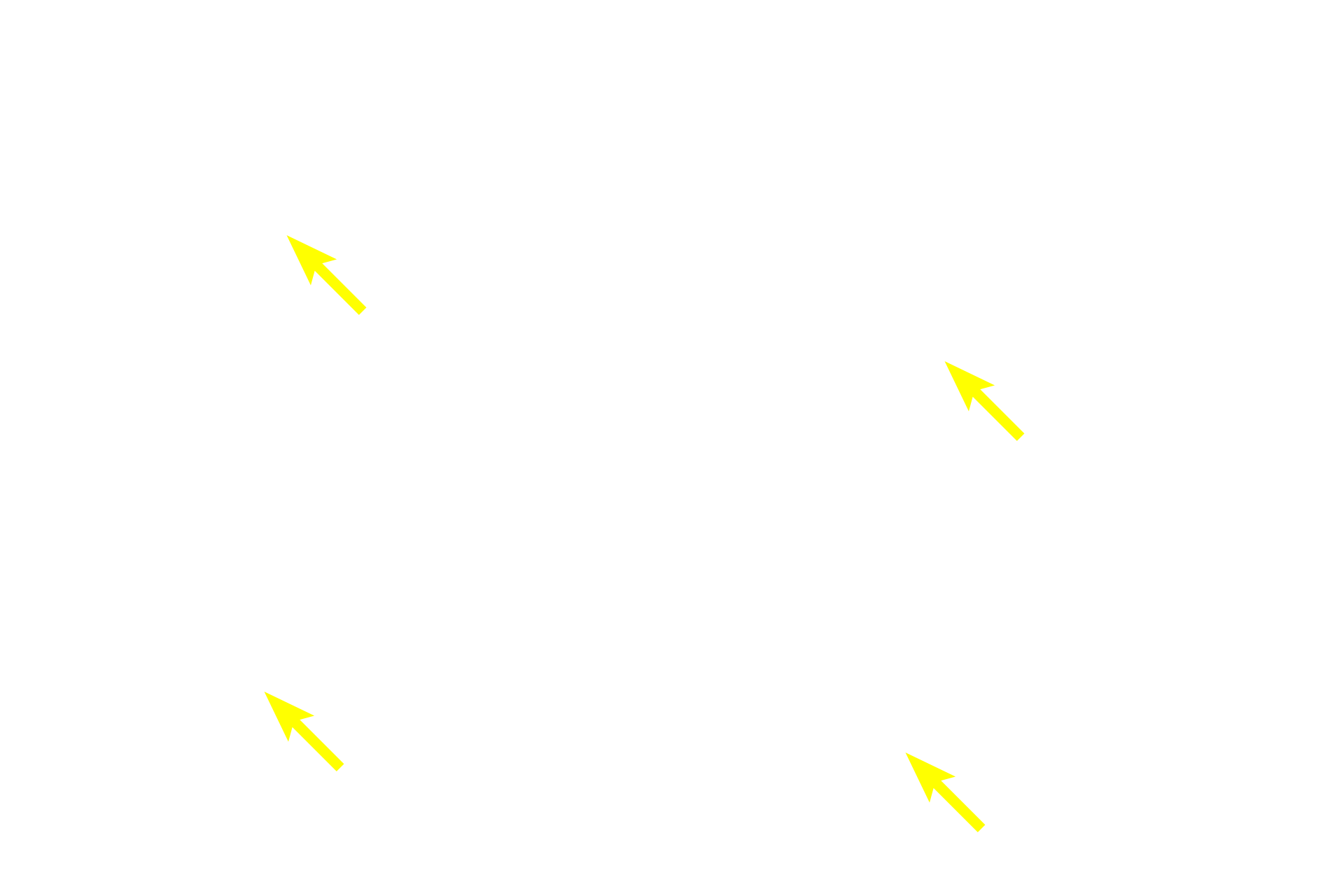  - Acini <p>A single lobule shows the relationship of the secretory acini and the draining duct system.  Intercalated ducts drain individual acini and then form intralobular, striated ducts.  Striated ducts converge at the center of the lobule eventually forming an interlobular duct that exists the lobule.  200x</p>
