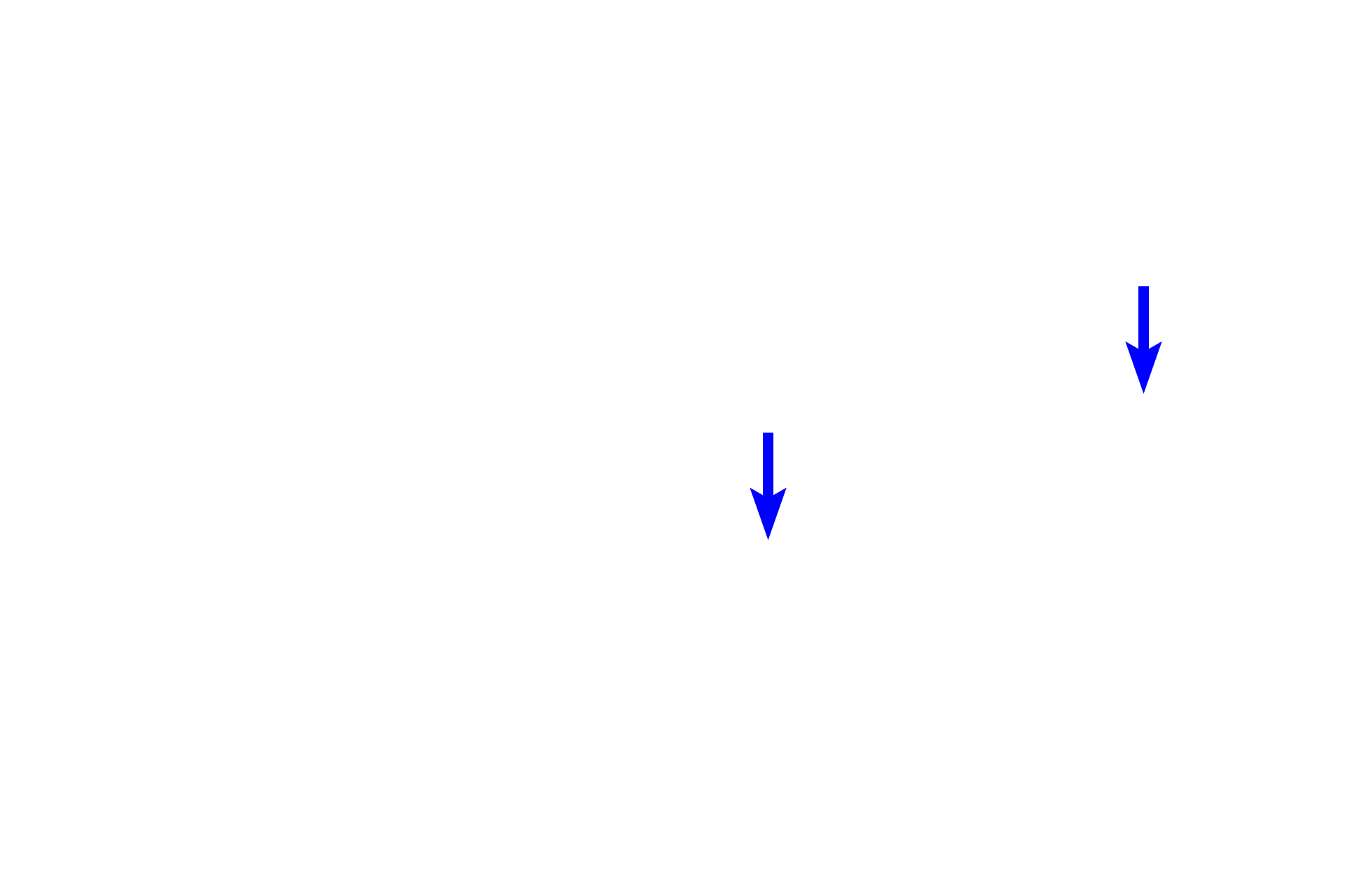 Interlobular ducts <p>A single lobule shows the relationship of the secretory acini and the draining duct system.  Intercalated ducts drain individual acini and then form intralobular, striated ducts.  Striated ducts converge at the center of the lobule eventually forming an interlobular duct that exists the lobule.  200x</p>

