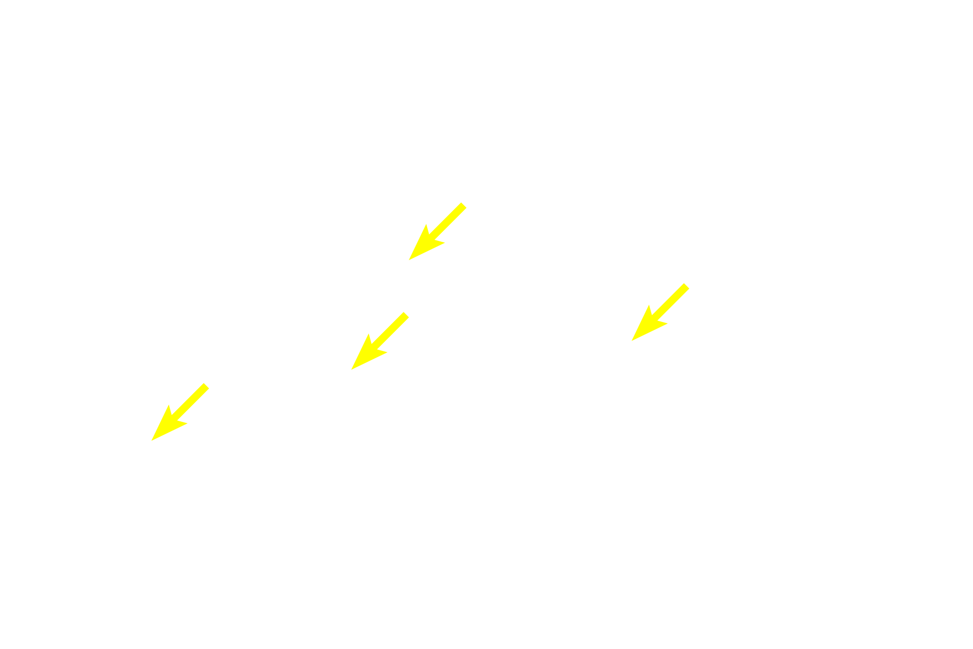  - Secretory granules <p>Each acinus is composed of a grapefruit-shaped cluster of serous-producing cells.  Nuclei are peripherally located at the base of the cells; red secretory granules accumulate adjacent to the small central lumen, where they will be released.  The granule contents and their large numbers cause acinar cells to stain intensely.  400x</p>
