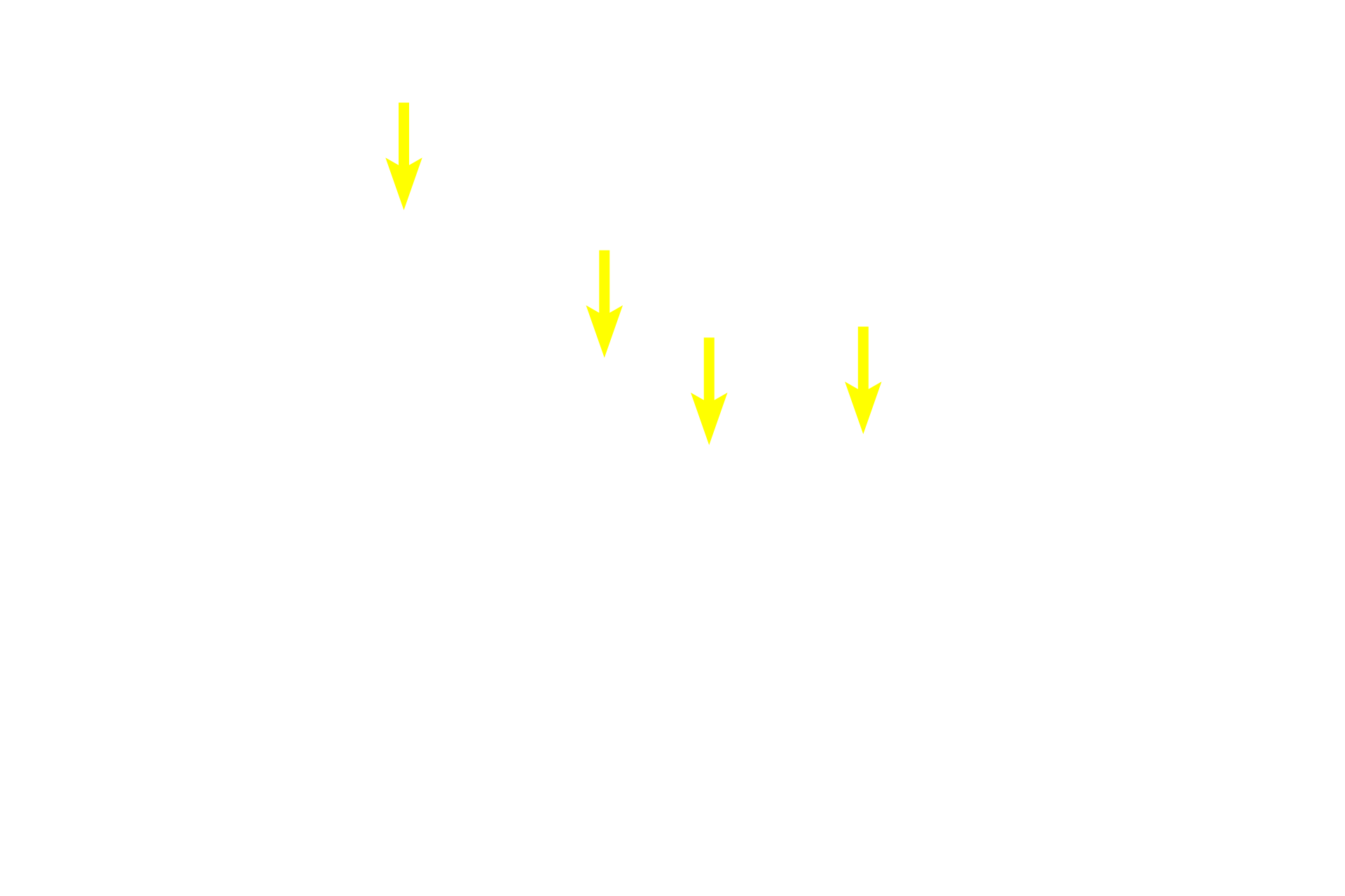  - Acinar lumens <p>Each acinus is composed of a grapefruit-shaped cluster of serous-producing cells.  Nuclei are peripherally located at the base of the cells; red secretory granules accumulate adjacent to the small central lumen, where they will be released.  The granule contents and their large numbers cause acinar cells to stain intensely.  400x</p>
