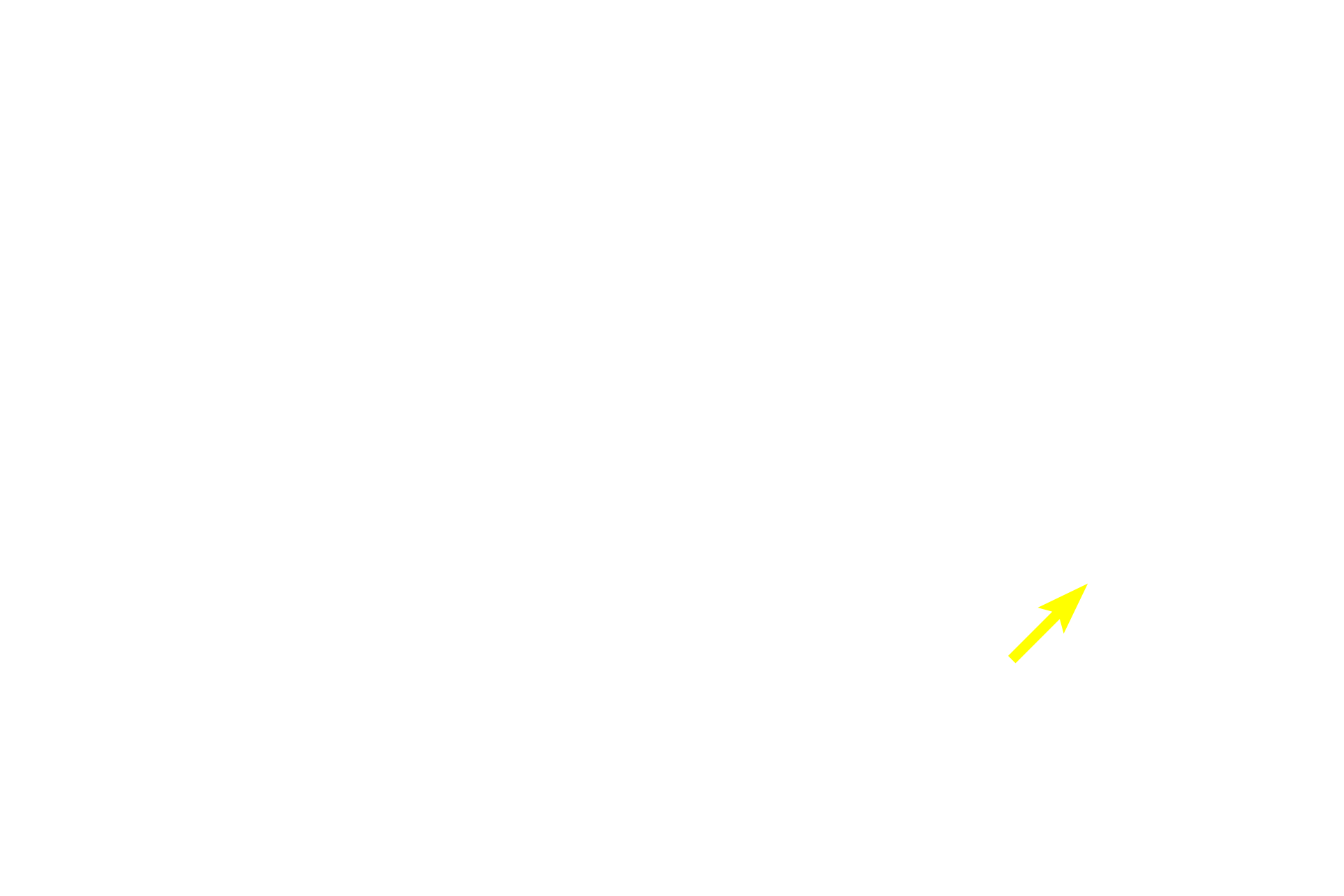 Intercalated duct > <p>Secretory product is transported from the acinar lumens into the smallest of the intralobular ducts, the intercalated ducts.  These ducts are lined by simple cuboidal epithelium and are smaller in diameter than surrounding acini.</p>
