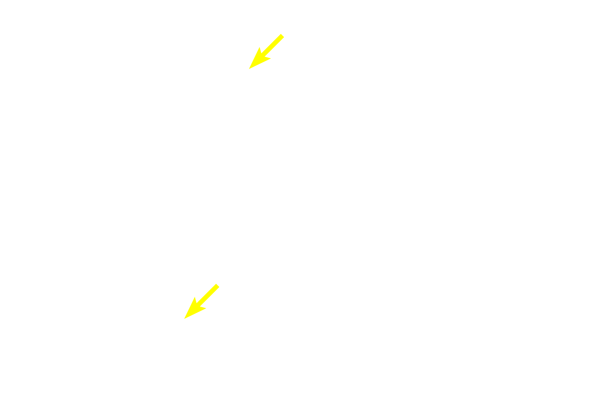 Striated ducts > <p>Intercalated ducts increase in size and anastomose to form another intralobular duct, the striated duct.  Striated ducts are as large as, or larger than, the surrounding acini and display basal striations.  These striations are formed by numerous infoldings of the basal plasma membrane and the many mitochondria that are interposed between the folds.</p>
