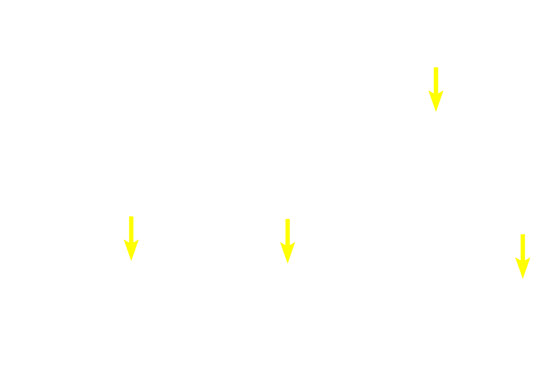  - Peripheral nuclei <p>A high magnification of serous acini demonstrates the organelles present in this grapefruit-shaped, secretory unit, as well as its central lumen into which the secretory product is released.  Once the saliva leaves the acinus, it will enter an intercalated duct.  1000x</p>
