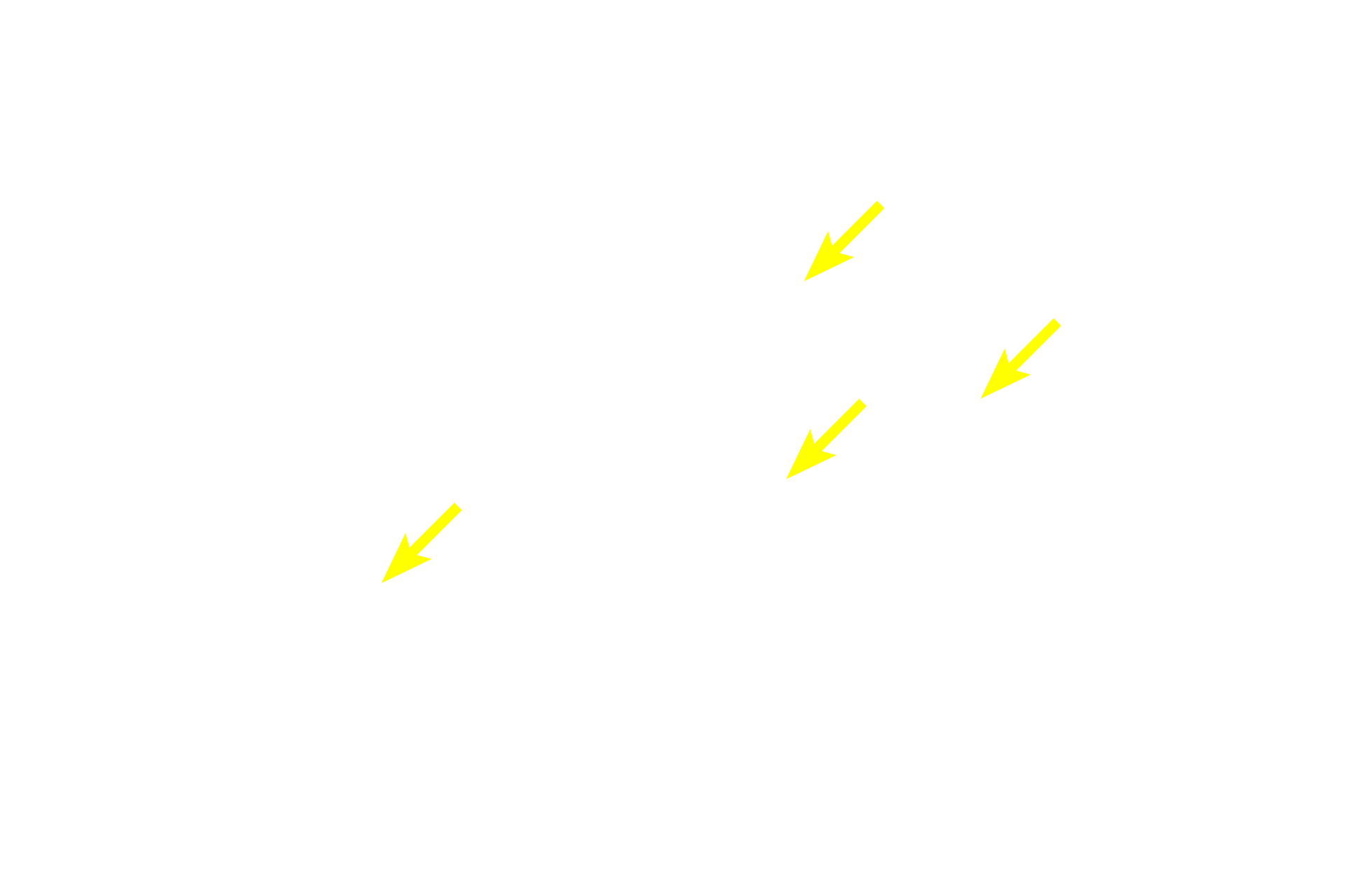  - Secretory granules <p>A high magnification of serous acini demonstrates the organelles present in this grapefruit-shaped, secretory unit, as well as its central lumen into which the secretory product is released.  Once the saliva leaves the acinus, it will enter an intercalated duct.  1000x</p>
