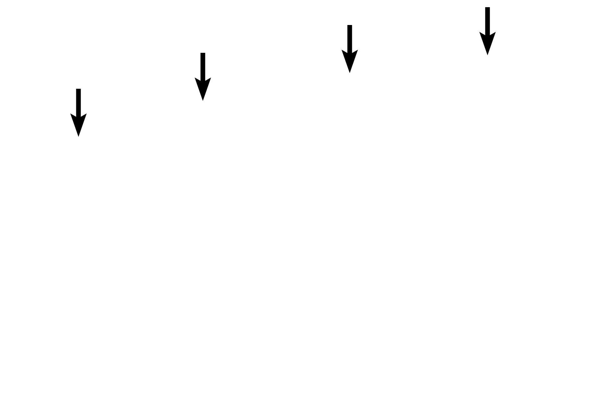 Dorsum of the tongue <p>The dorsum of the tongue is covered by a stratified squamous keratinized epithelium with filiform, fungiform, and circumvallate (not seen here) papillae.  The ventral surface of the tongue is covered by a stratified squamous moist epithelium (lining mucosa).  The core of the tongue contains intrinsic and extrinsic skeletal muscles and connective tissue.  10x</p>
