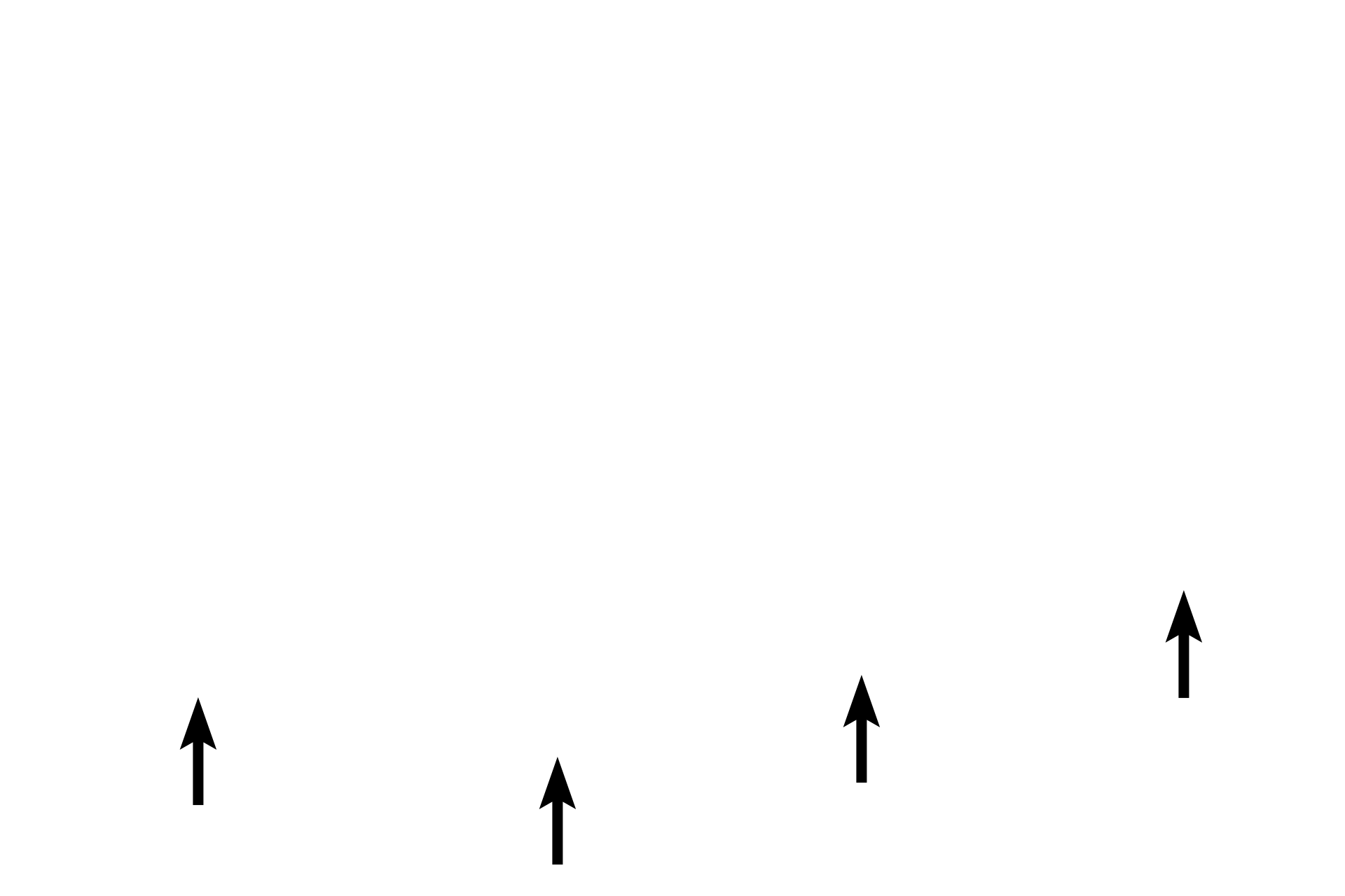 Ventral surface <p>The dorsum of the tongue is covered by a stratified squamous keratinized epithelium with filiform, fungiform, and circumvallate (not seen here) papillae.  The ventral surface of the tongue is covered by a stratified squamous moist epithelium (lining mucosa).  The core of the tongue contains intrinsic and extrinsic skeletal muscles and connective tissue.  10x</p>
