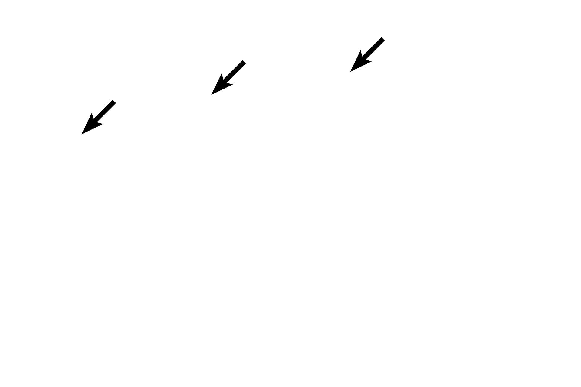Filiform papillae <p>The dorsum of the tongue is covered by a stratified squamous keratinized epithelium with filiform, fungiform, and circumvallate (not seen here) papillae.  The ventral surface of the tongue is covered by a stratified squamous moist epithelium (lining mucosa).  The core of the tongue contains intrinsic and extrinsic skeletal muscles and connective tissue.  10x</p>
