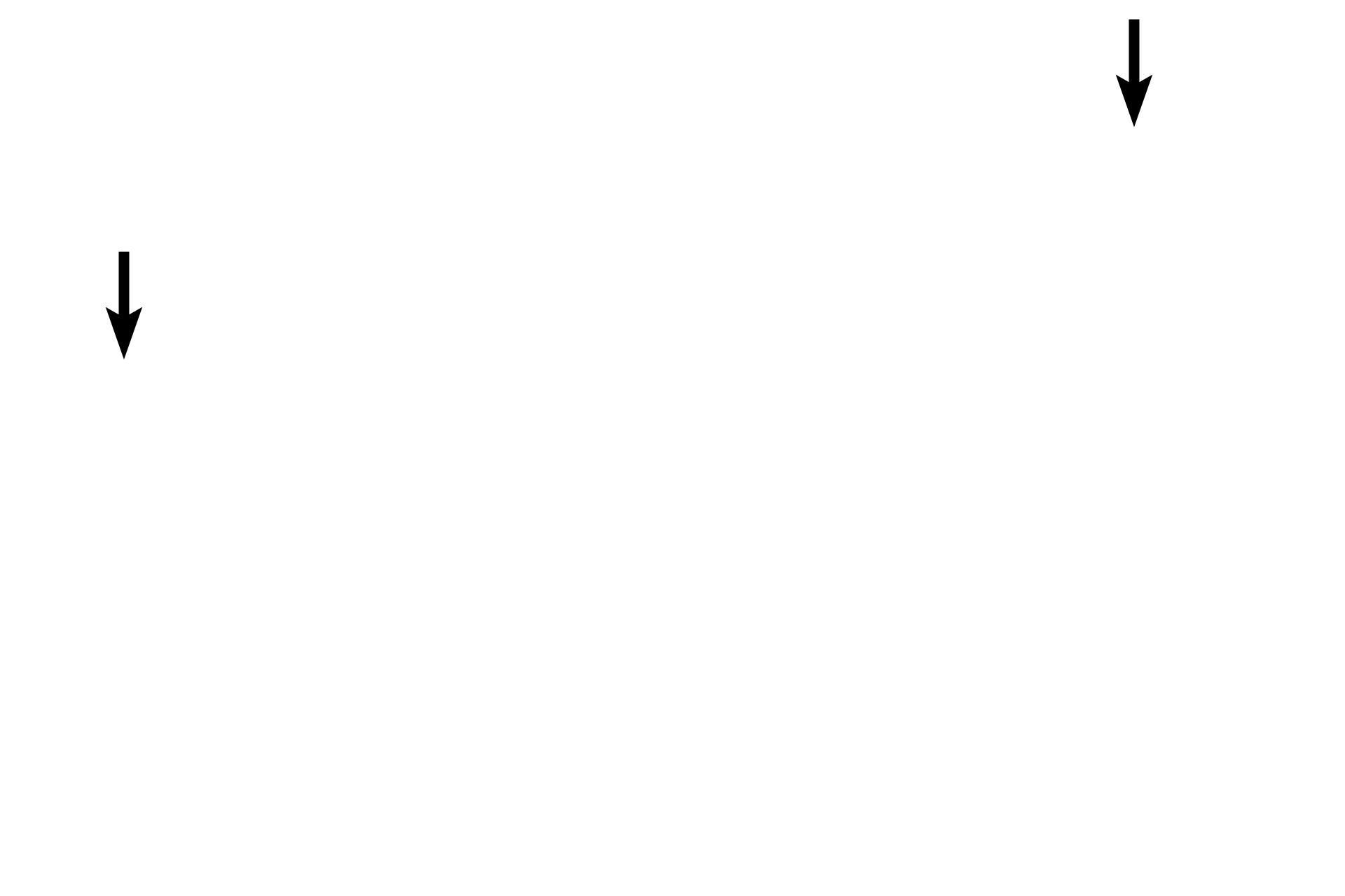 Fungiform papillae <p>The dorsum of the tongue is covered by a stratified squamous keratinized epithelium with filiform, fungiform, and circumvallate (not seen here) papillae.  The ventral surface of the tongue is covered by a stratified squamous moist epithelium (lining mucosa).  The core of the tongue contains intrinsic and extrinsic skeletal muscles and connective tissue.  10x</p>
