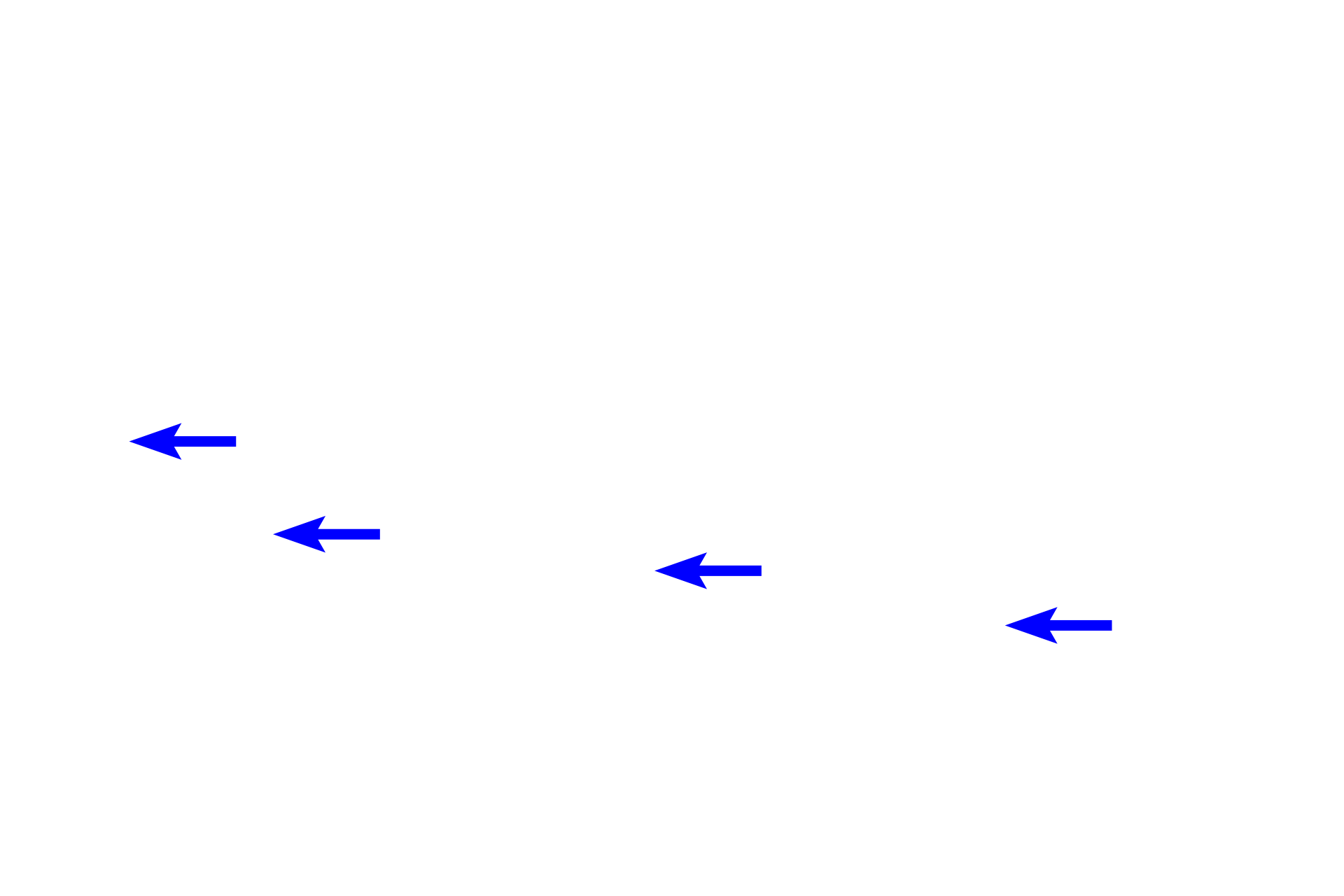  - Connective tissue core <p>The dorsal and lateral surfaces of the tongue are covered by specialized mucosa forming papillae:  filiform, fungiform, circumvallate, and foliate.  The tapering filiform papillae seen here are the most numerous type, covering most of the anterior two thirds of the tongue. Each papilla is about two to three millimeters long and is composed of a conical tip of keratinized, stratified squamous epithelium and an underlying core of connective tissue.  100x</p>
