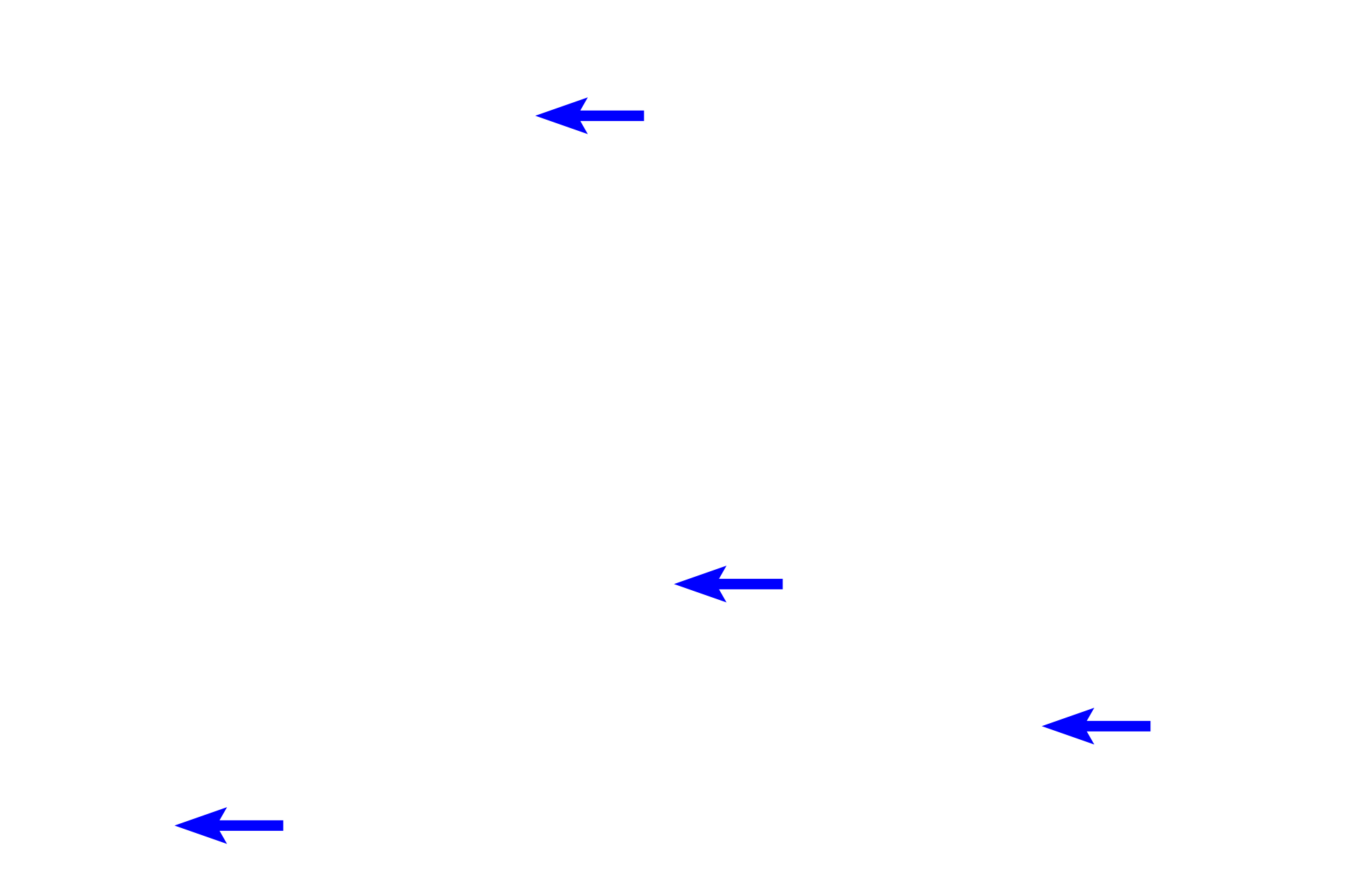 Connective tissue cores <p>Filiform and fungiform papillae. Filiform papillae with their conical morphology surround a fungiform papilla which protrudes slightly above the filiform.  Both types of papillae are covered by a keratinized epithelium.  Although scattered taste buds may be present on the dorsum of fungiform papillae, none are visible here.  100x</p>
