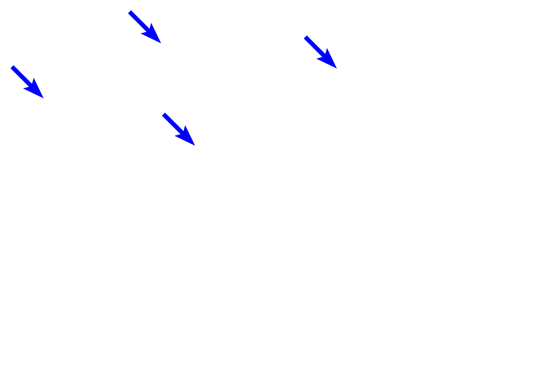 Keratinized epithelium <p>Filiform and fungiform papillae. Filiform papillae with their conical morphology surround a fungiform papilla which protrudes slightly above the filiform.  Both types of papillae are covered by a keratinized epithelium.  Although scattered taste buds may be present on the dorsum of fungiform papillae, none are visible here.  100x</p>
