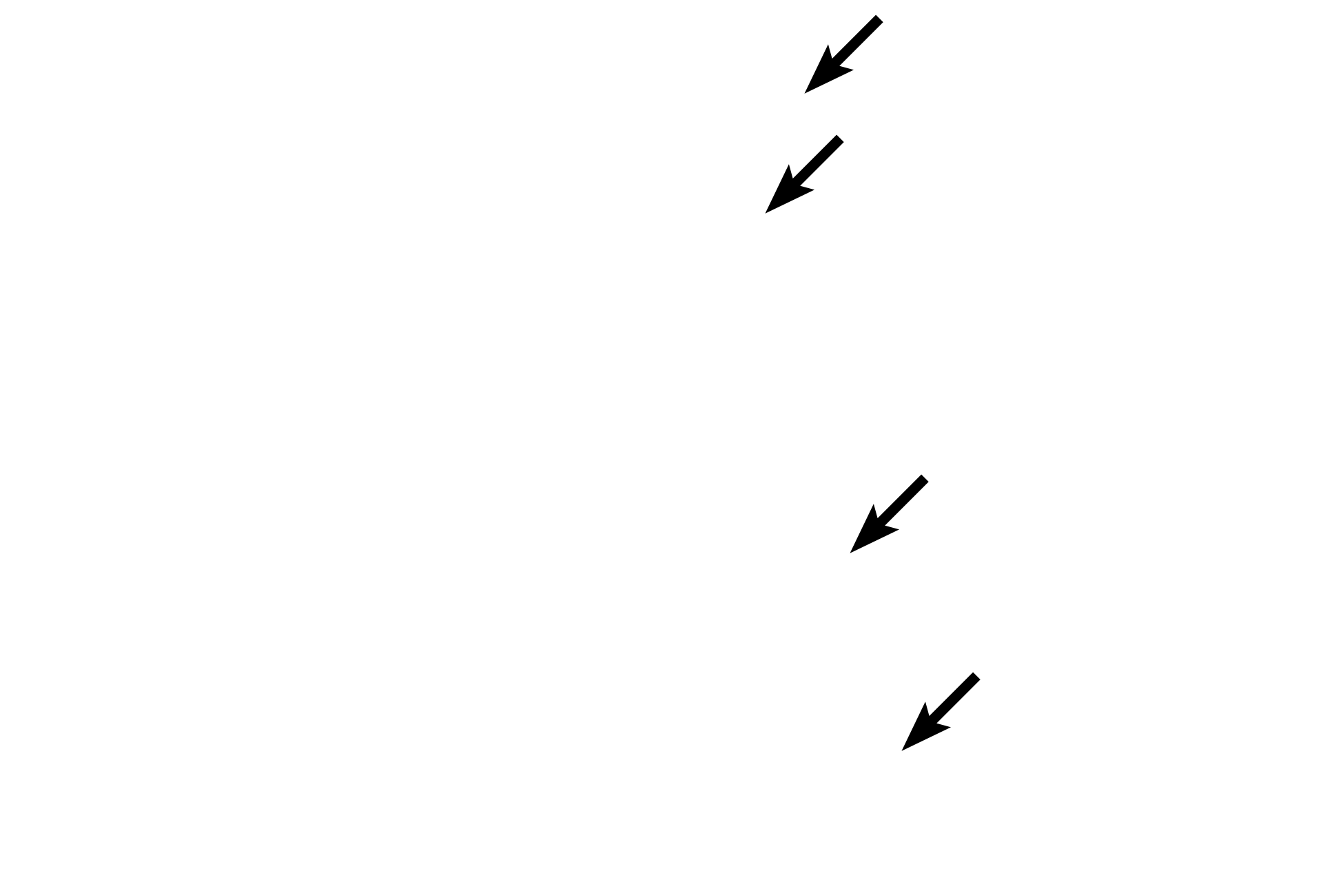  - Taste buds <p>Along the lateral edges of the circumvallate papillae are oval taste buds, which access the oral cavity through a taste pore.  Taste buds are composed of supportive cells and neuroepithelial cells that are innervated by sensory neurons of the facial nerve (cranial nerve VII).  40x, 400x</p>
