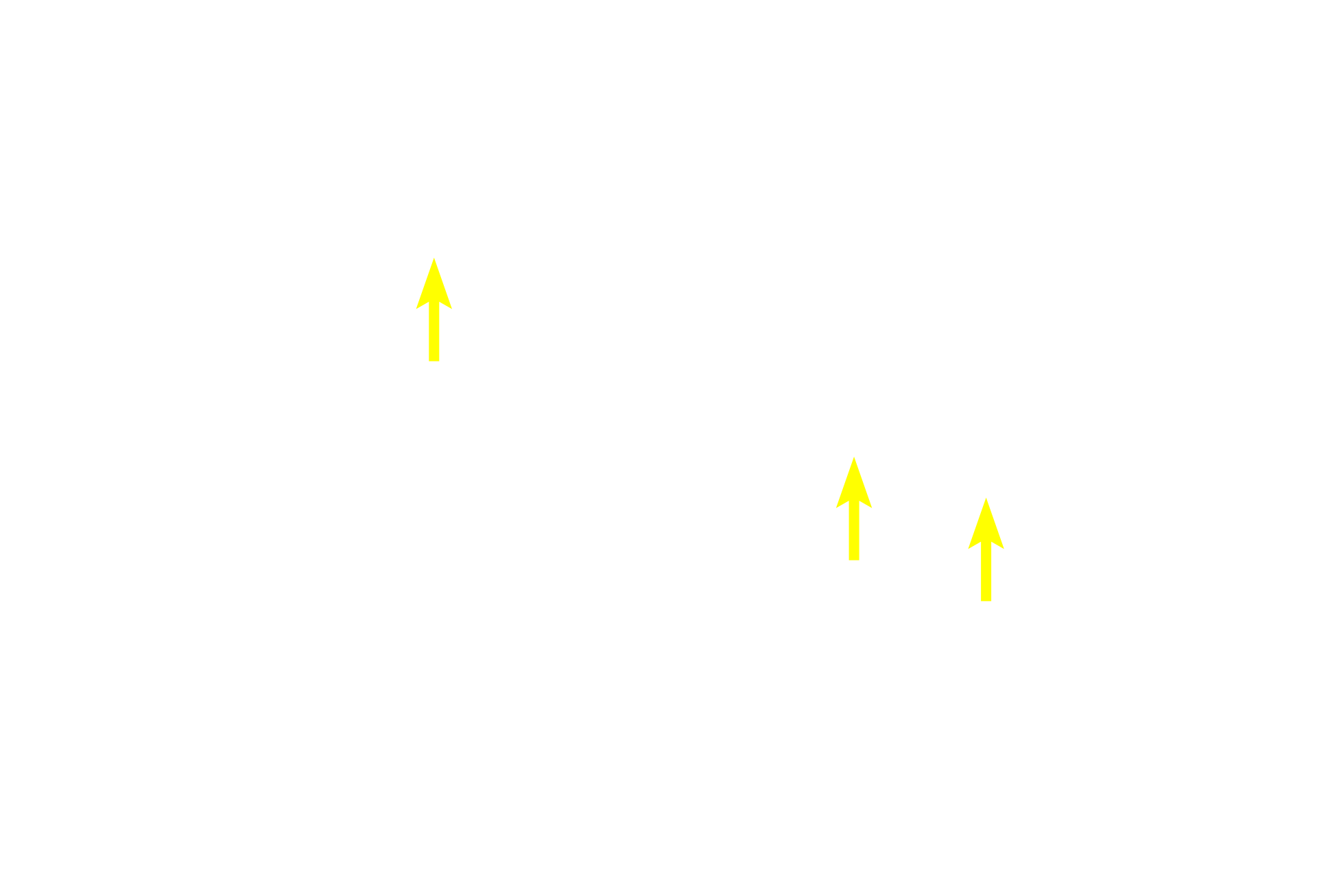  - Basal cells <p>Taste buds contain three cell types: neuroepithelial (sensory) cells, which are the most numerous cell type; supporting cells; and basal (stem) cells.  Sensory and supporting cells extend from the base of the taste bud to the taste pore.  Sensory cells, whose nuclei are more euchromatic than supporting cells, extend microvilli into the pore to detect tastant molecules. 400x</p>
