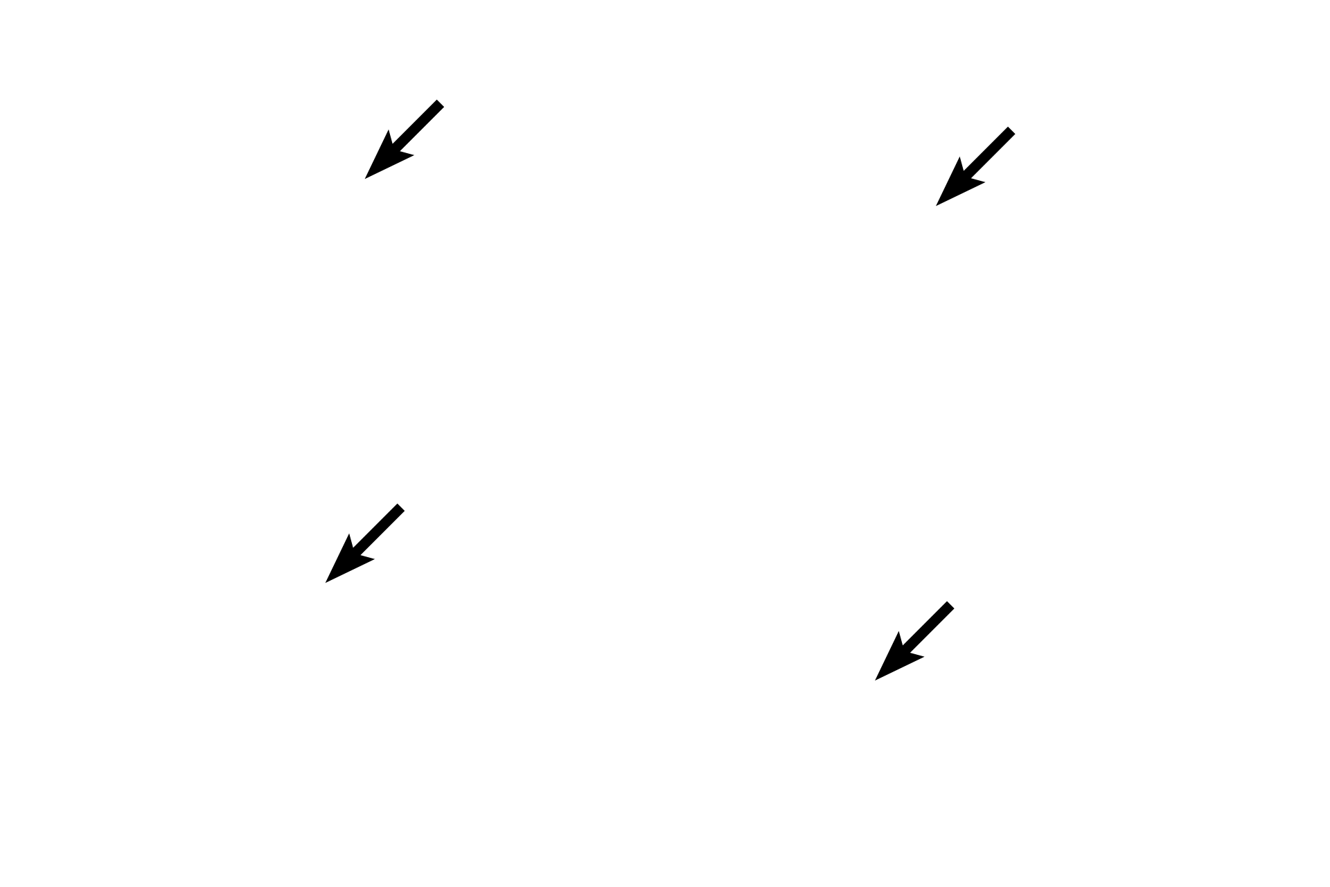 Transverse muscle fibers <p>Motility of the tongue is controlled by extrinsic and intrinsic skeletal muscles.  The intrinsic muscles, seen here, originate within and insert into the tongue.  Muscle fibers are arranged in criss-crossing fascicles and their actions change the shape of the tongue.  Extrinsic muscles originate outside the tongue and serve to move the tongue in and out of the mouth. 400x</p>
