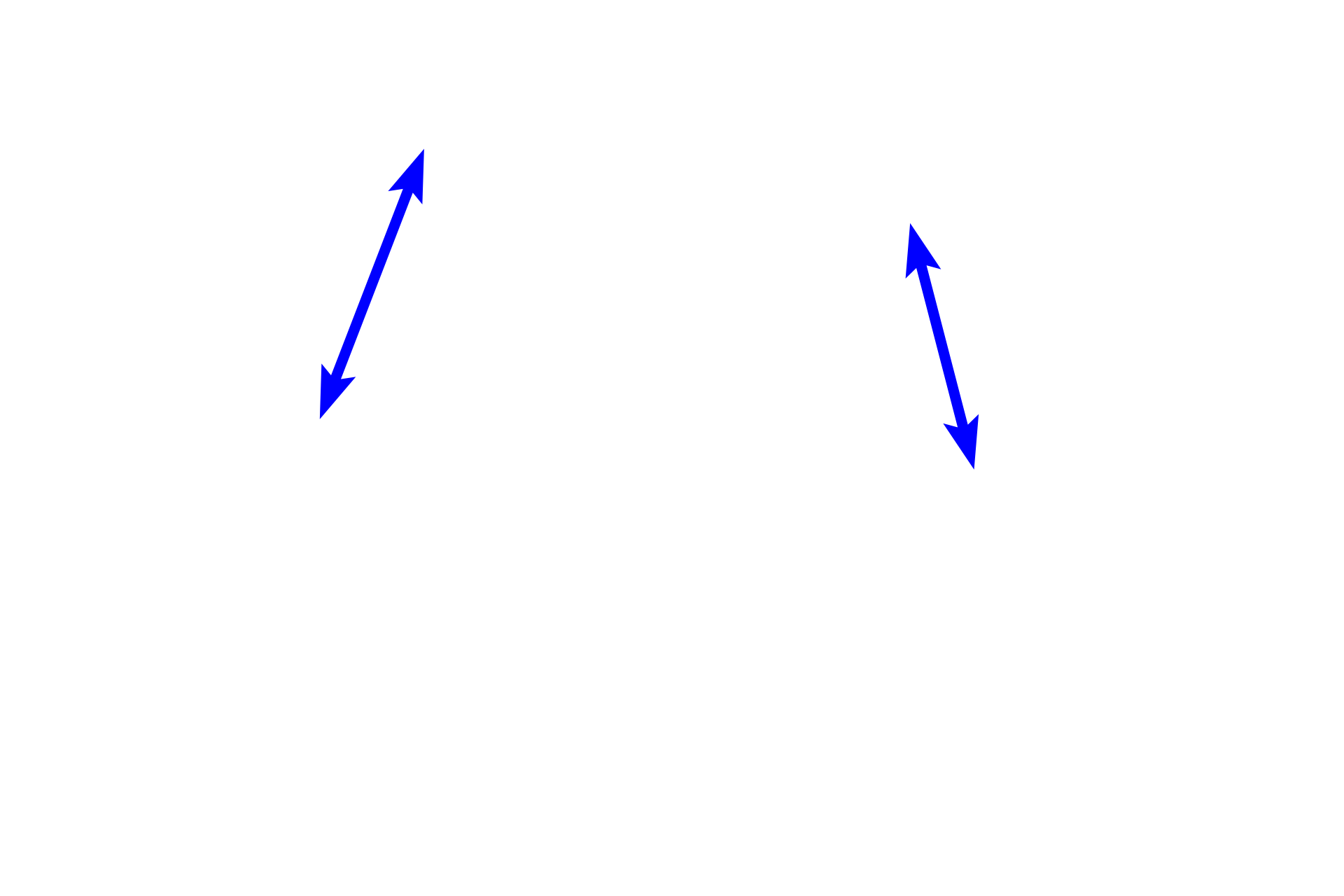 Masticatory epithelium > <p>The stratified squamous epithelium forming part of the masticatory mucosa covers the gingiva and may be either ortho- or parakeratinized.  The lamina propria of this mucosa is firmly attached to the tooth and to the underlying alveolar bone.</p>
