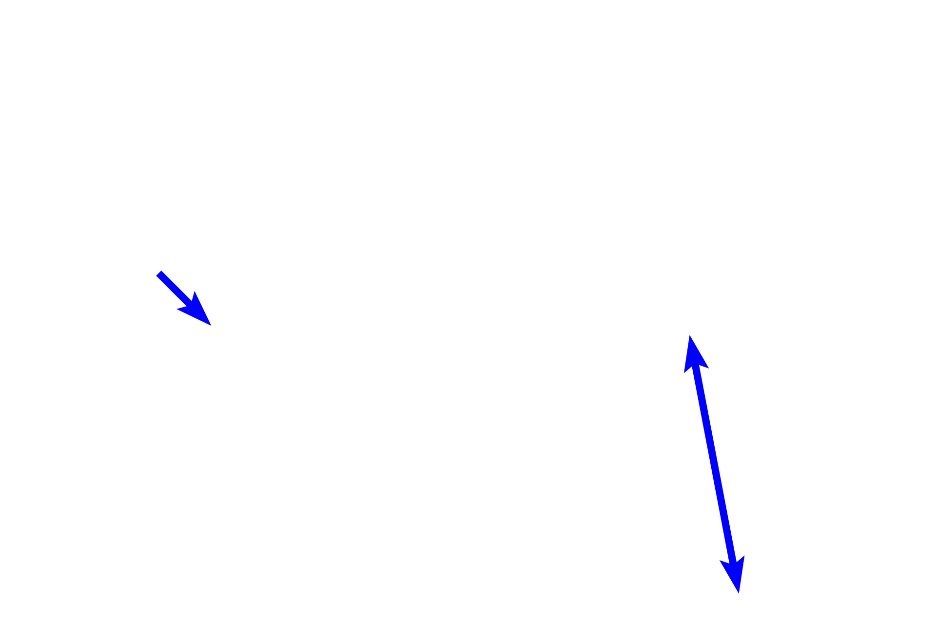 Lining mucosa > <p>Lining mucosa continues from the masticatory mucosa and usually possesses stratified squamous moist epithelium.  It appears to be parakeratinized in this image, however, probably due to extra trauma to this area.</p>
